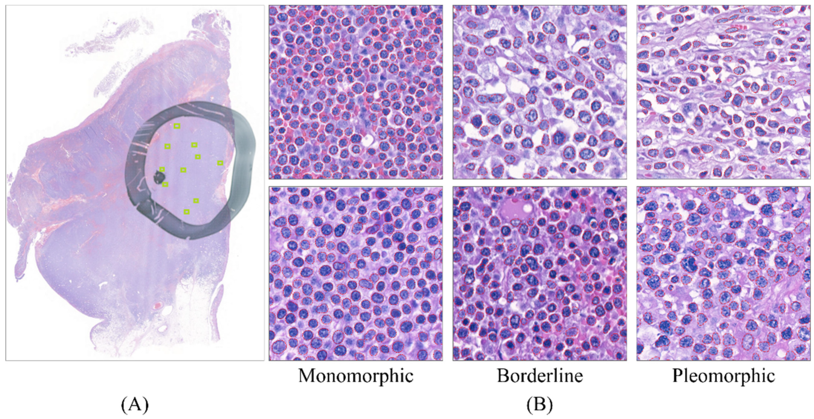 Cancers 13 05463 g001