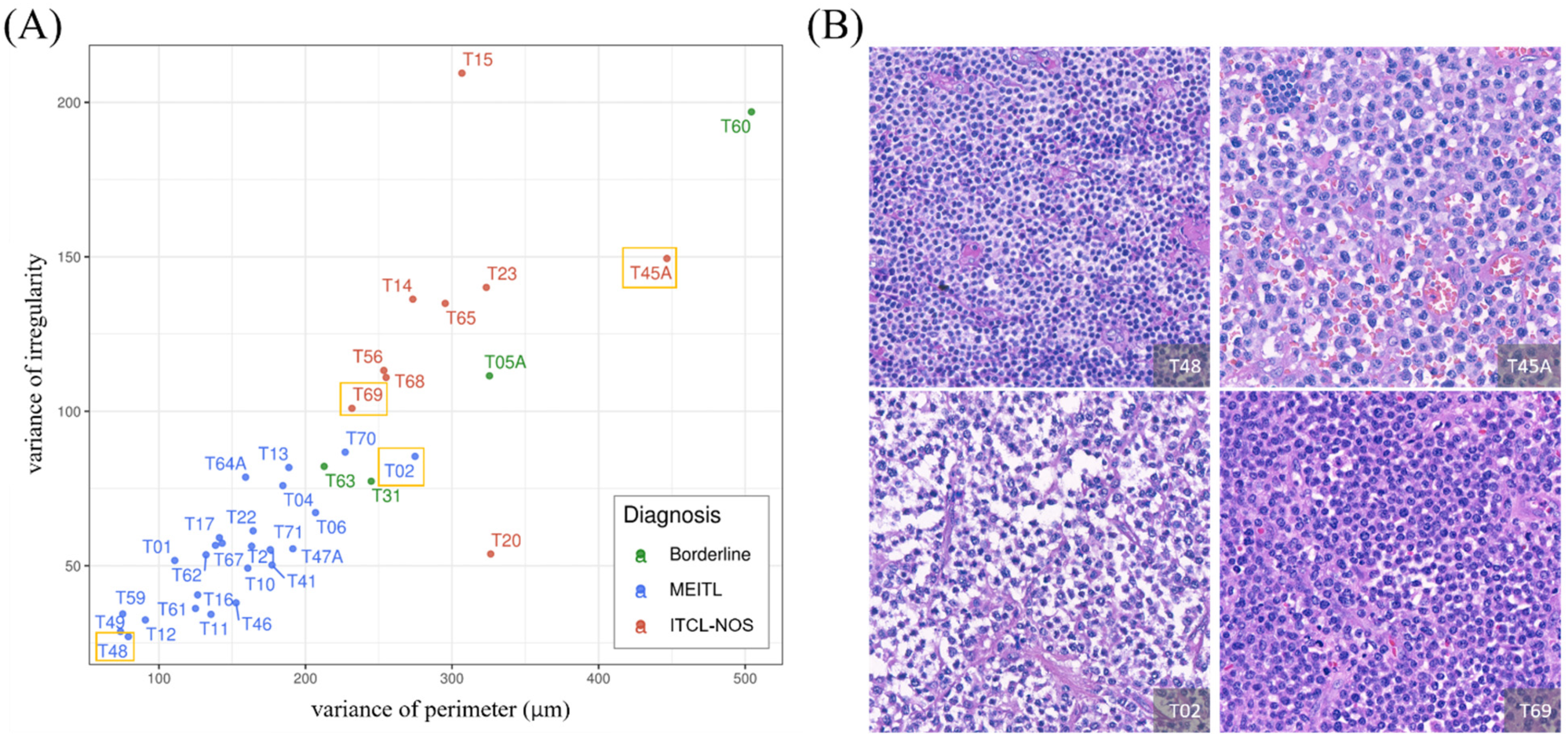Cancers 13 05463 g004