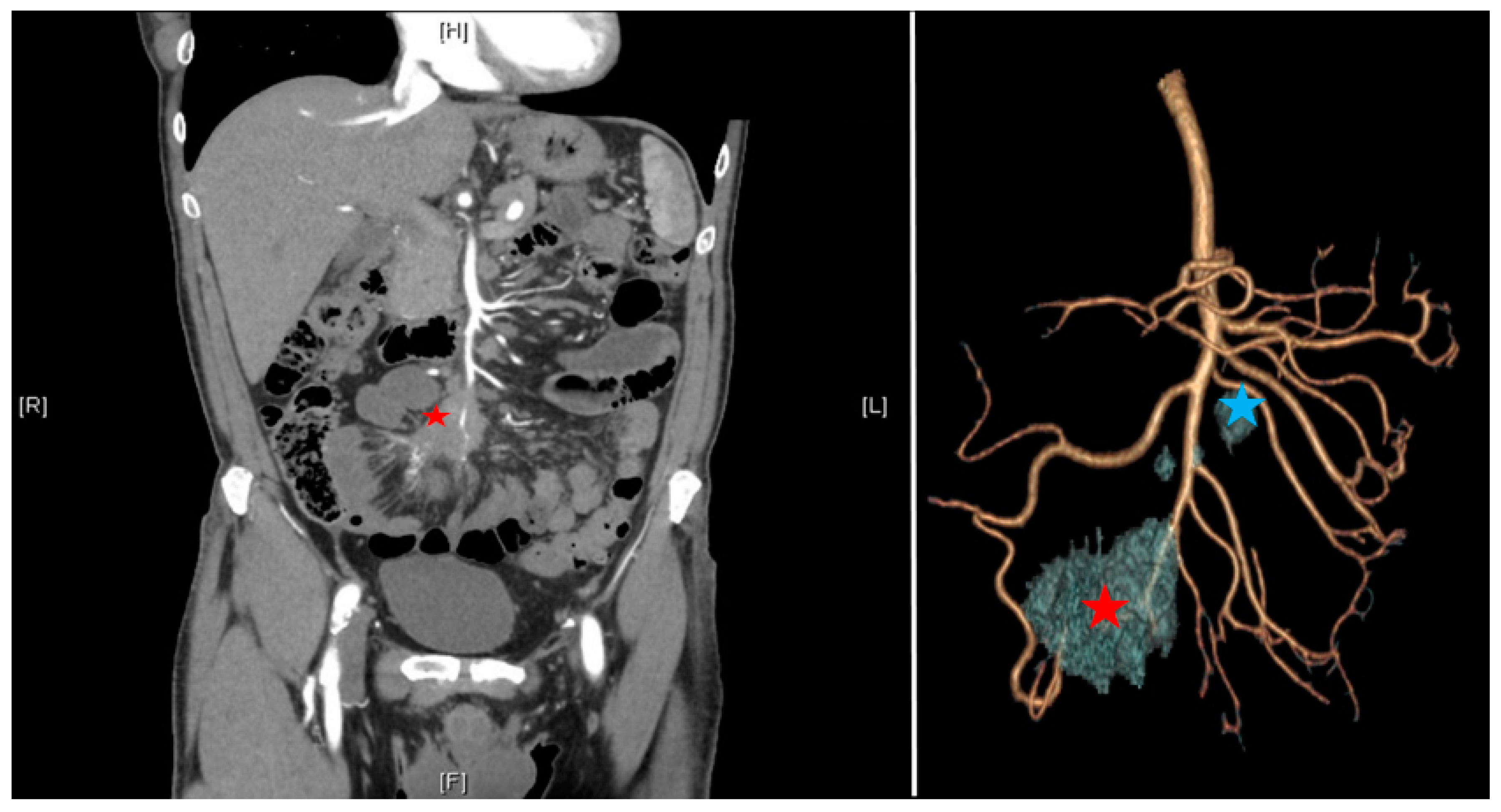 Cancers 13 05473 g002