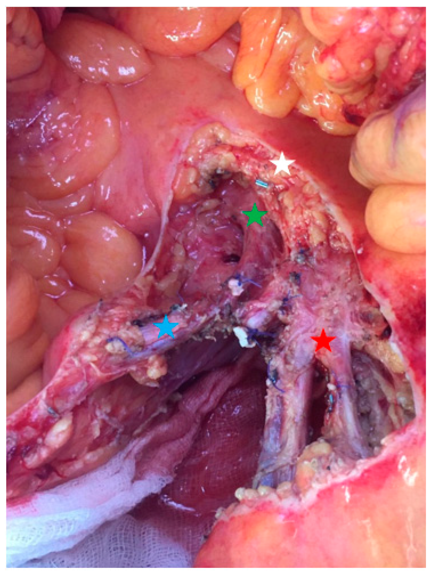 Cancers 13 05473 g005