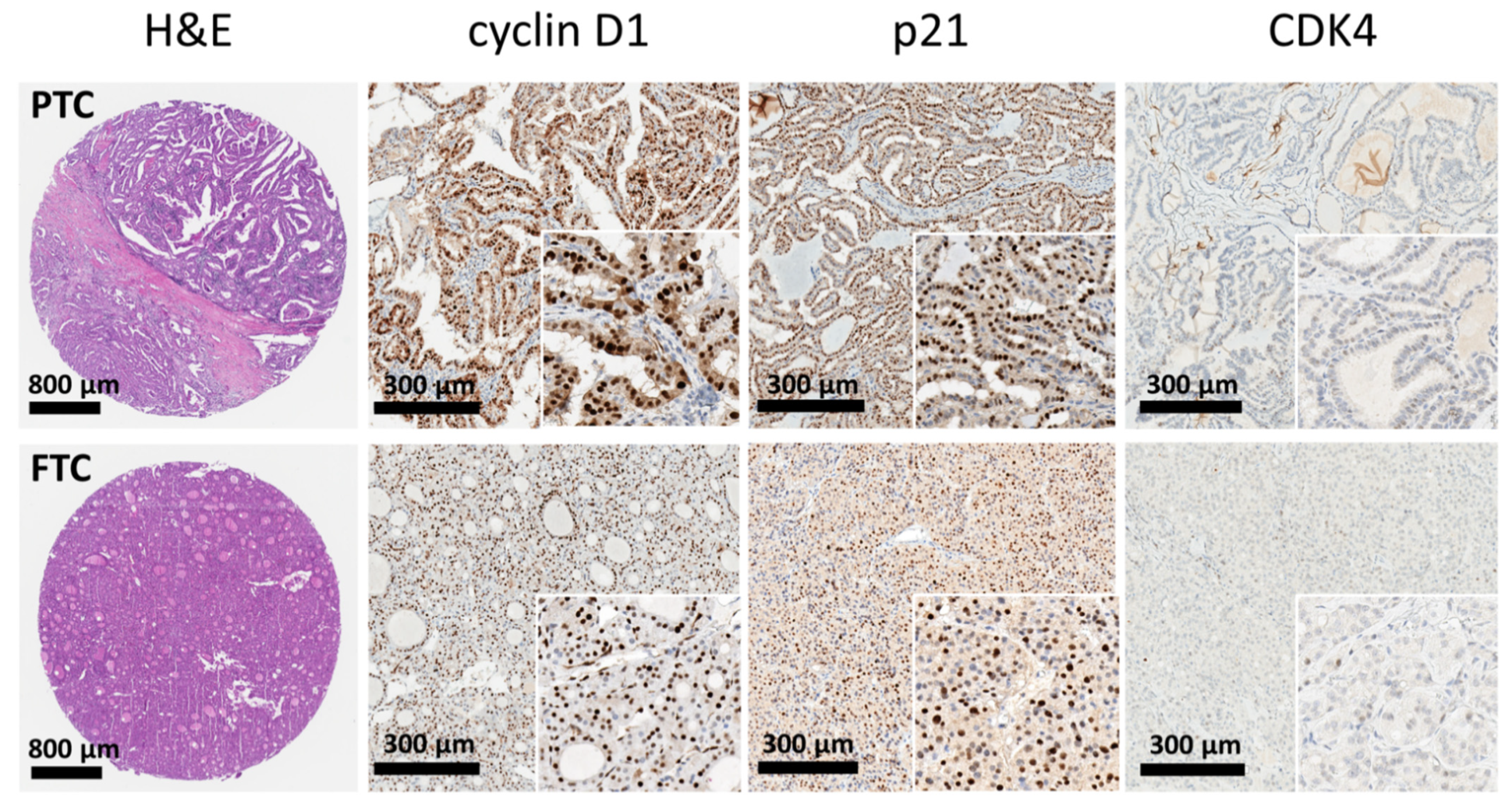 Cancers 13 05486 g001