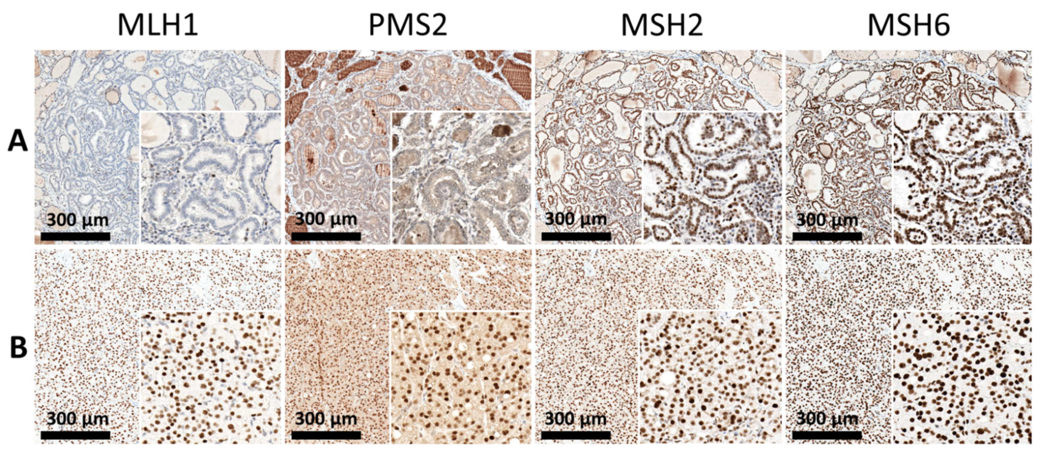 Cancers 13 05486 g002