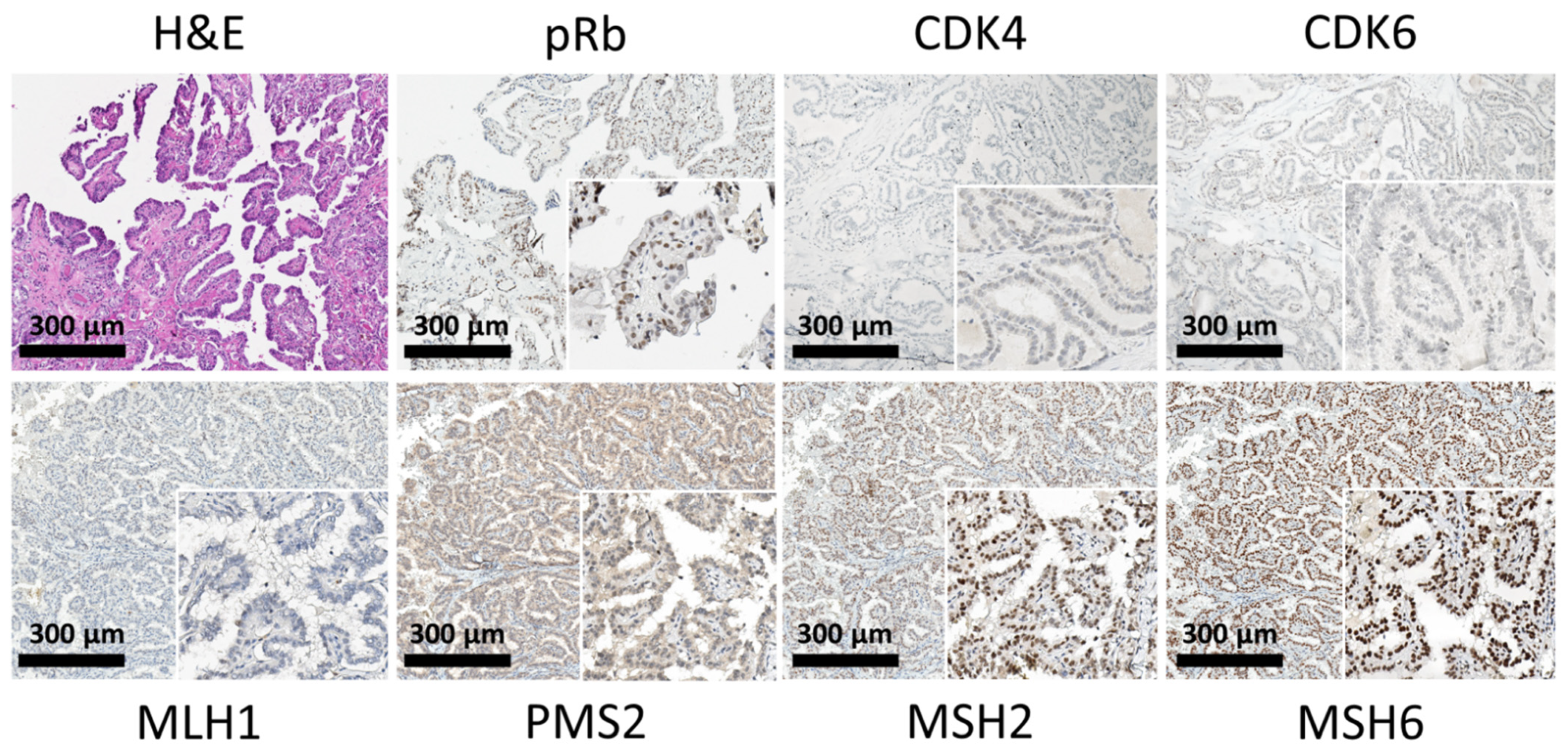 Cancers 13 05486 g003