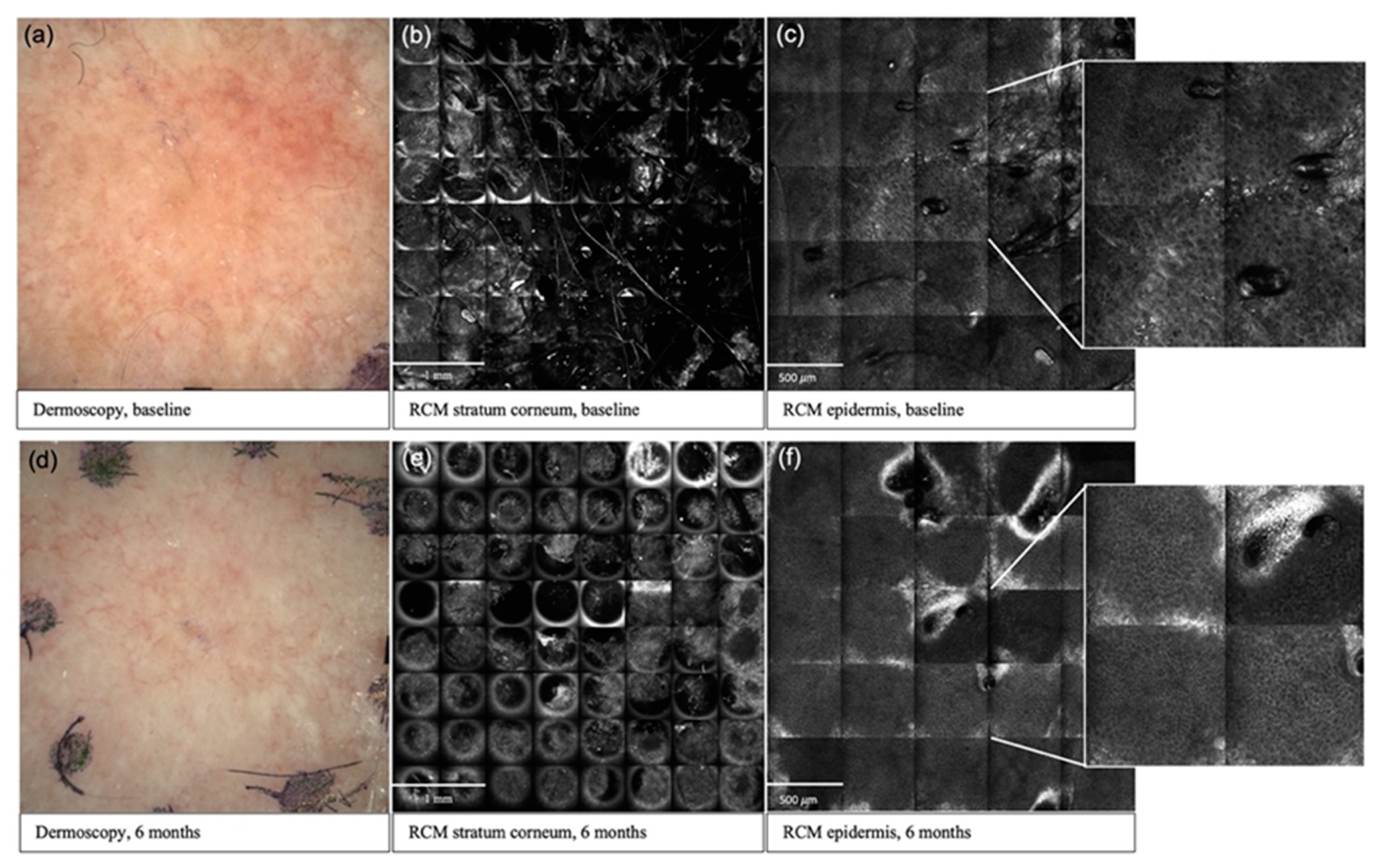 Cancers 13 05488 g001