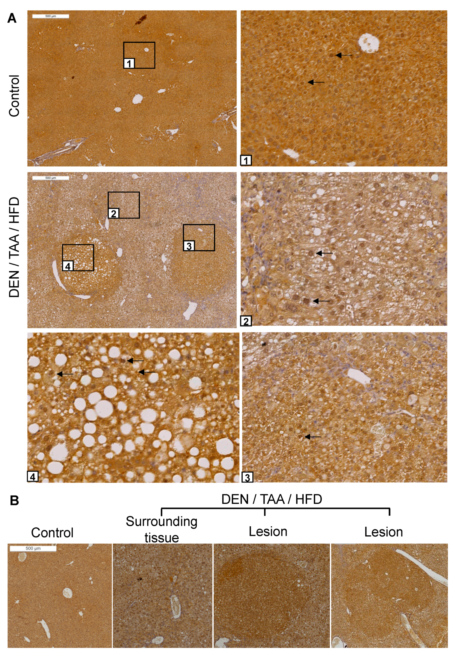 Cancers 13 05495 g002