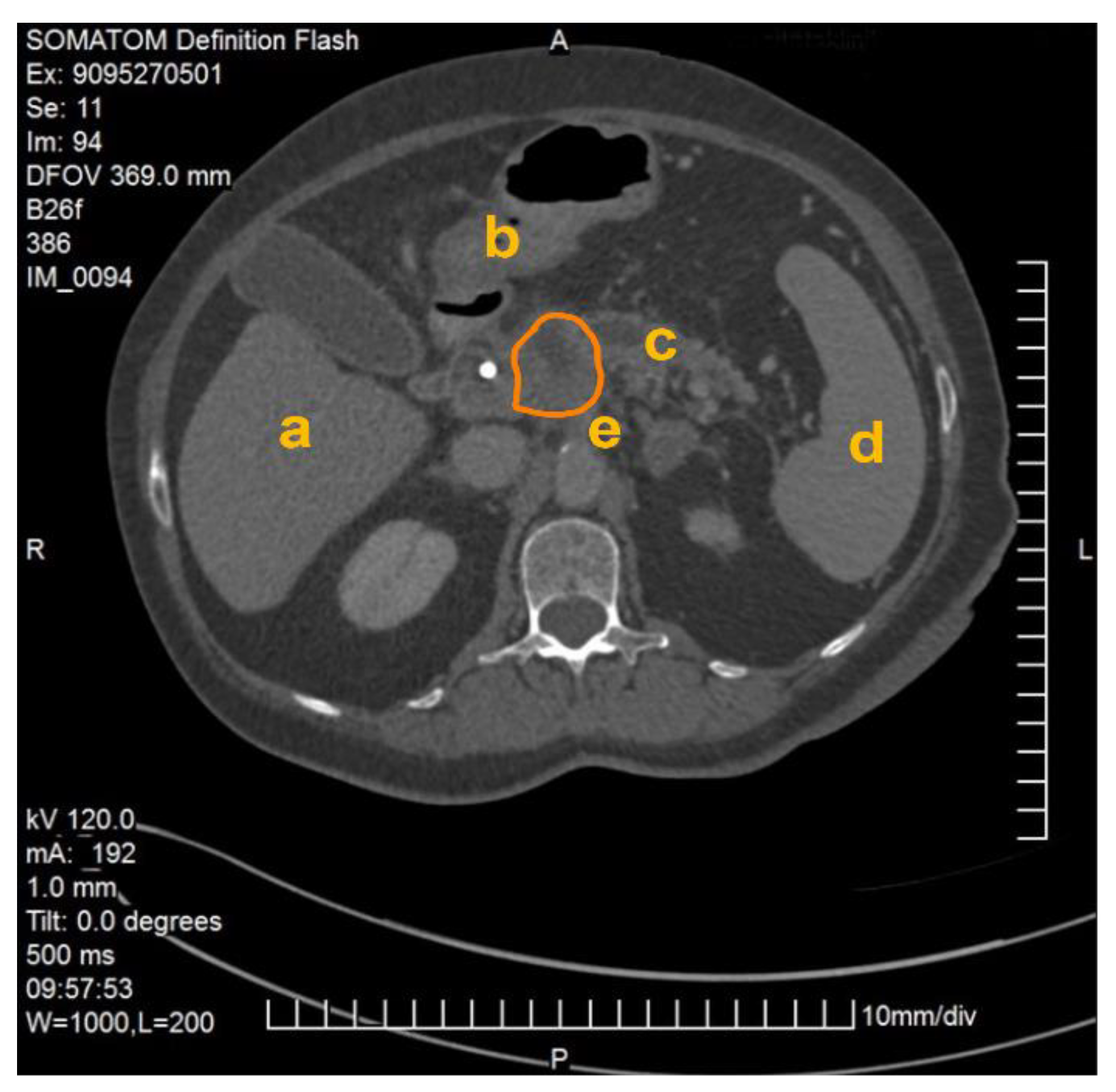 Cancers 13 05496 g001