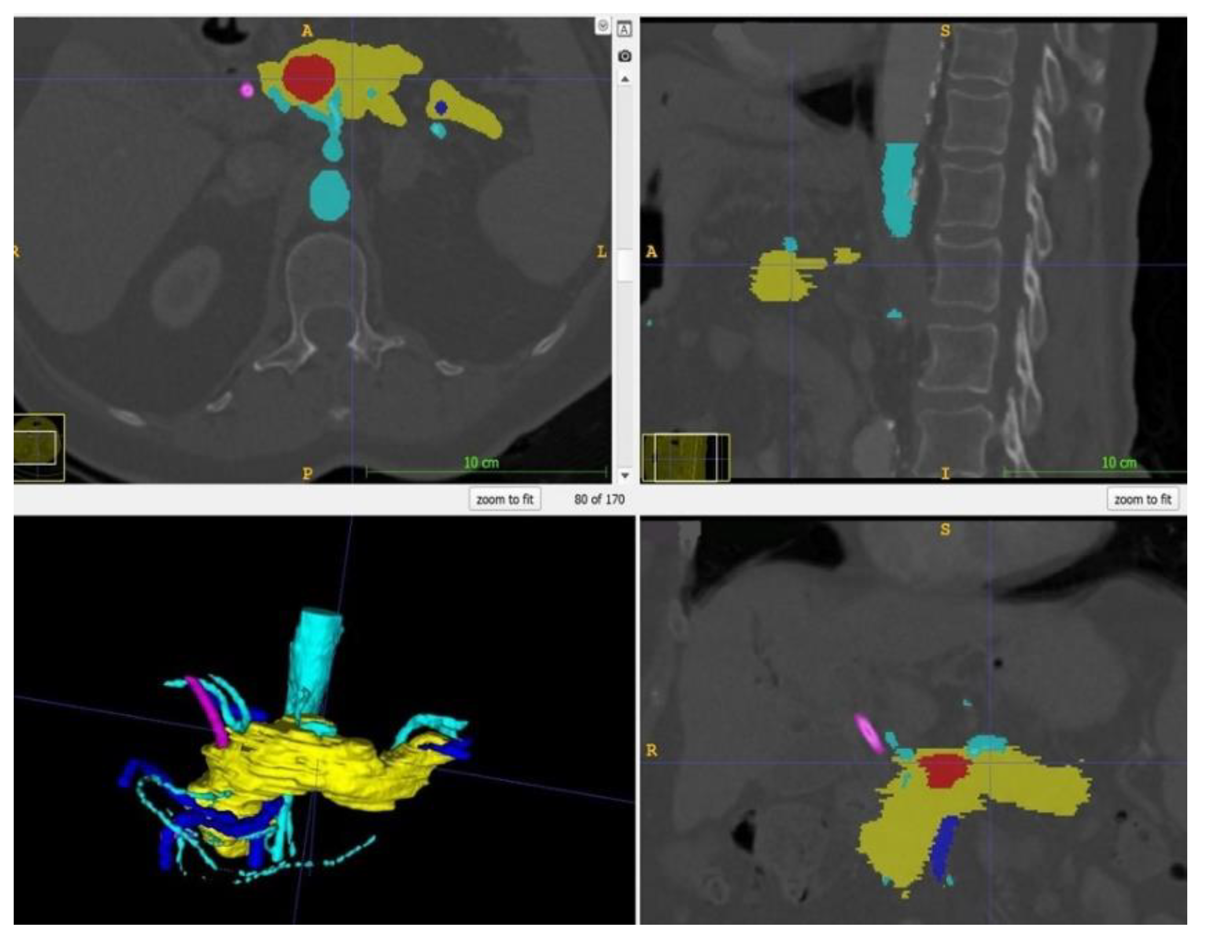 Cancers 13 05496 g002