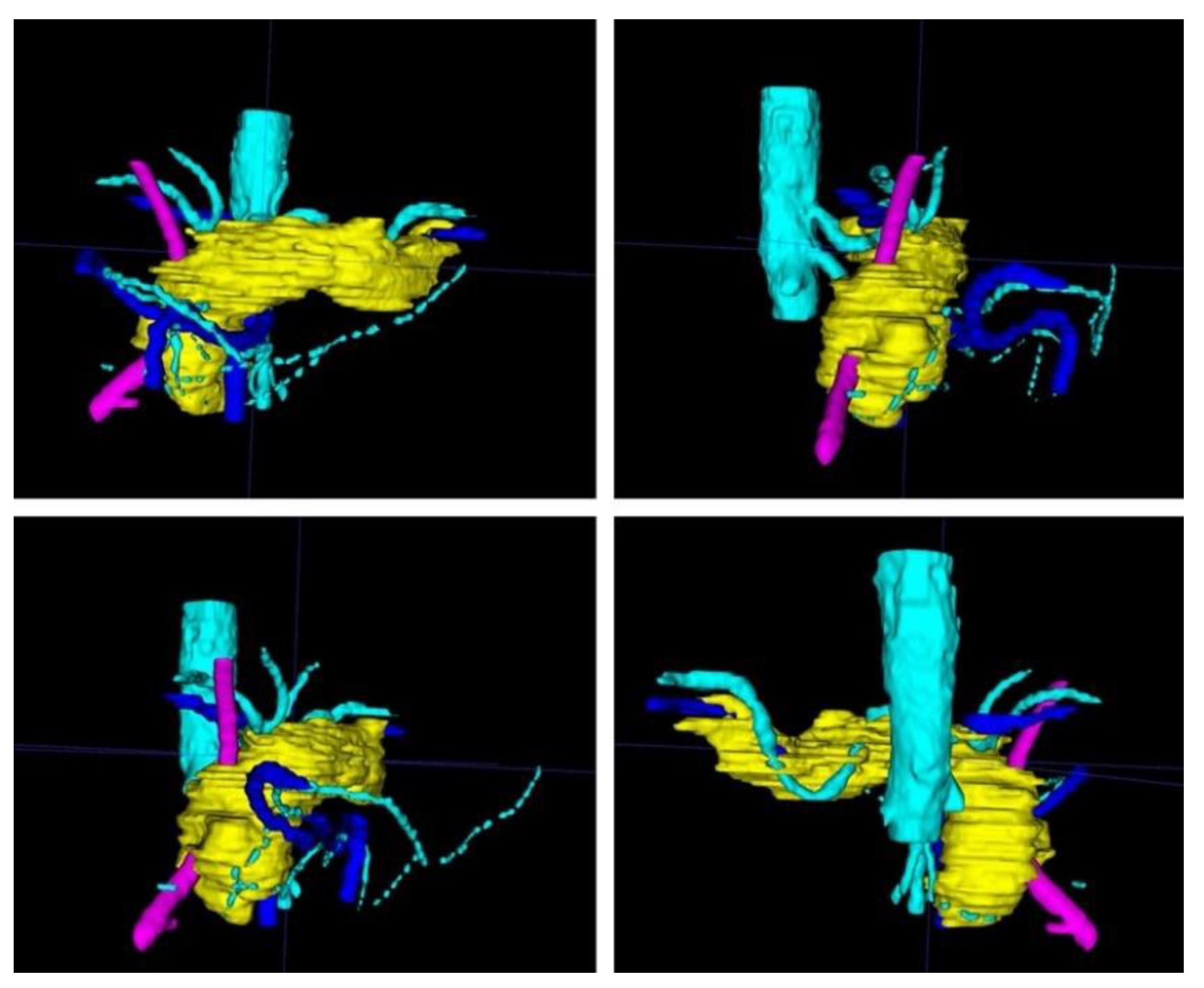 Cancers 13 05496 g003