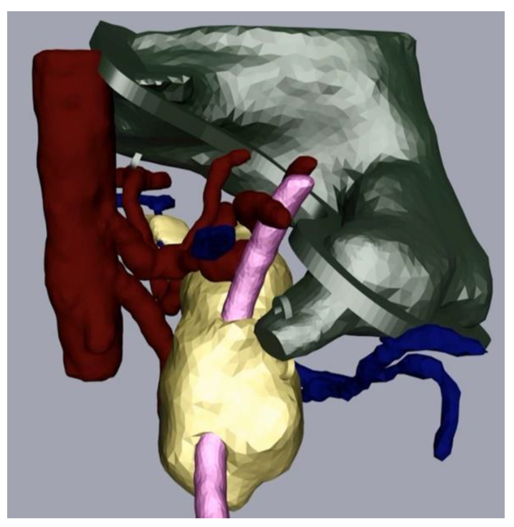 Cancers 13 05496 g004