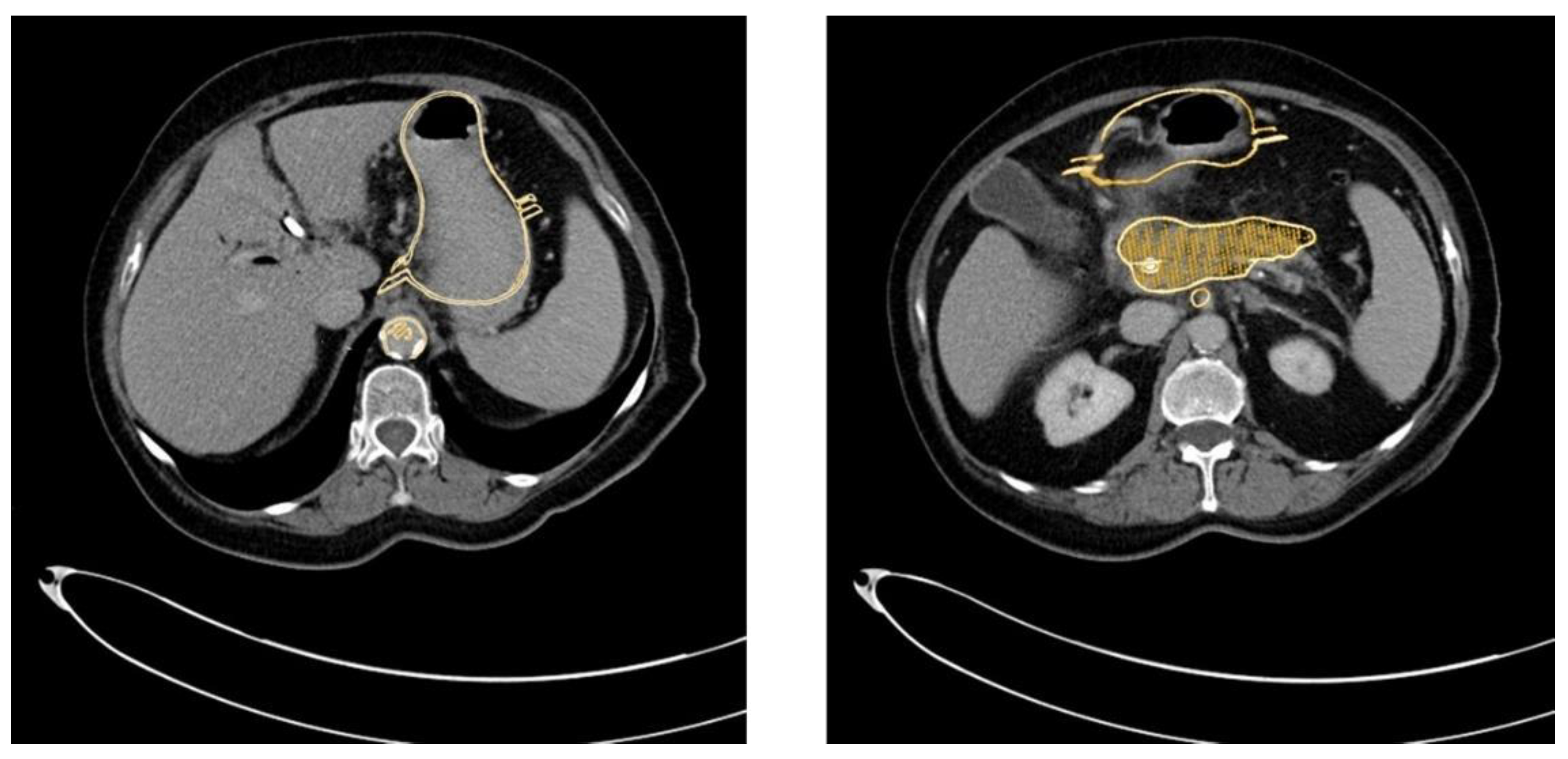 Cancers 13 05496 g009