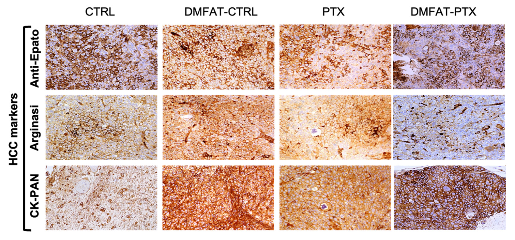 Cancers 13 05505 g004