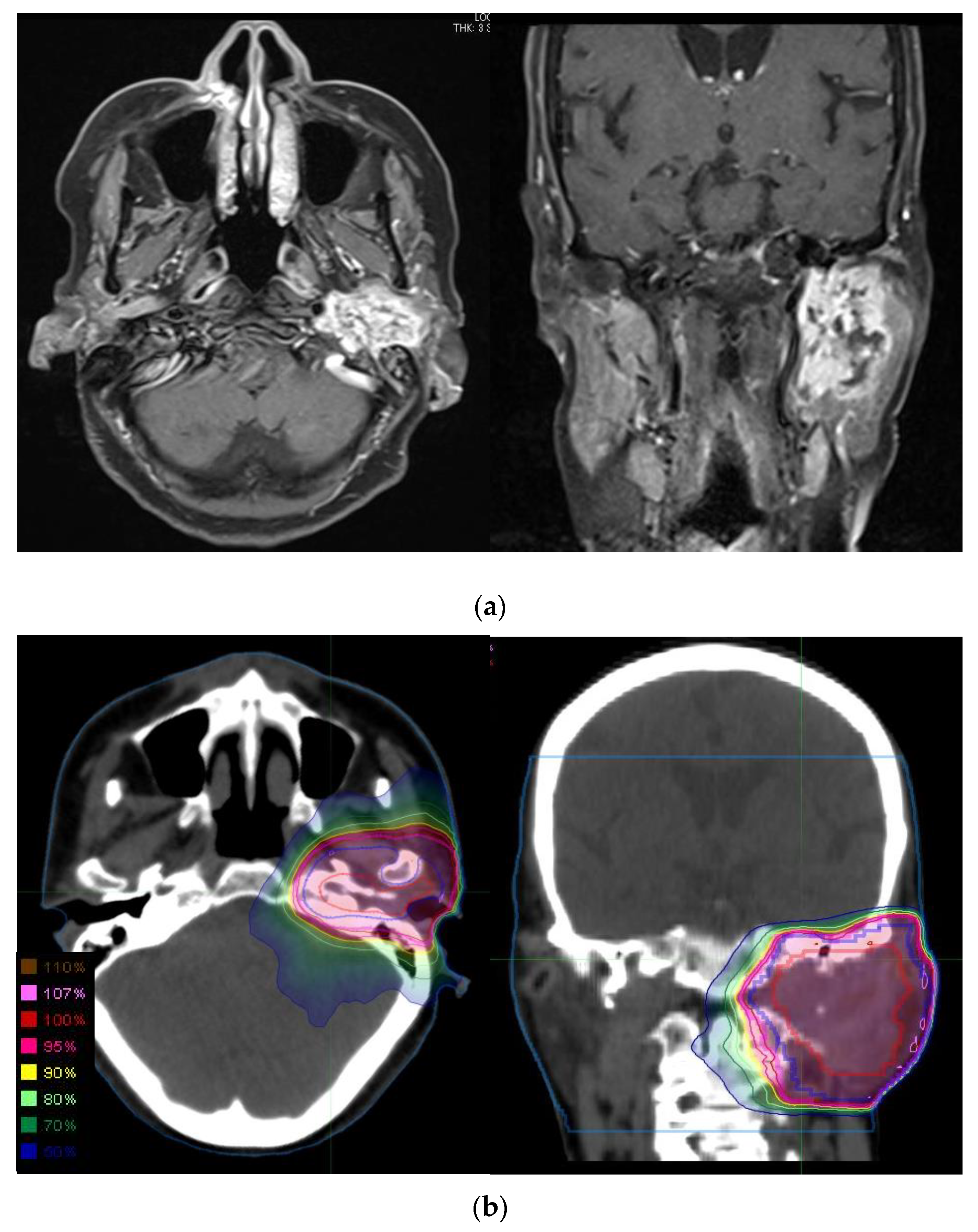 Cancers 13 05507 g001