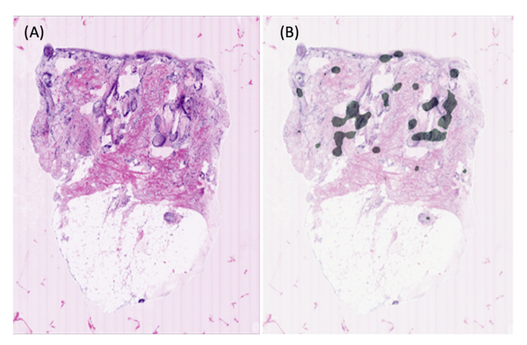 Cancers 13 05522 g003