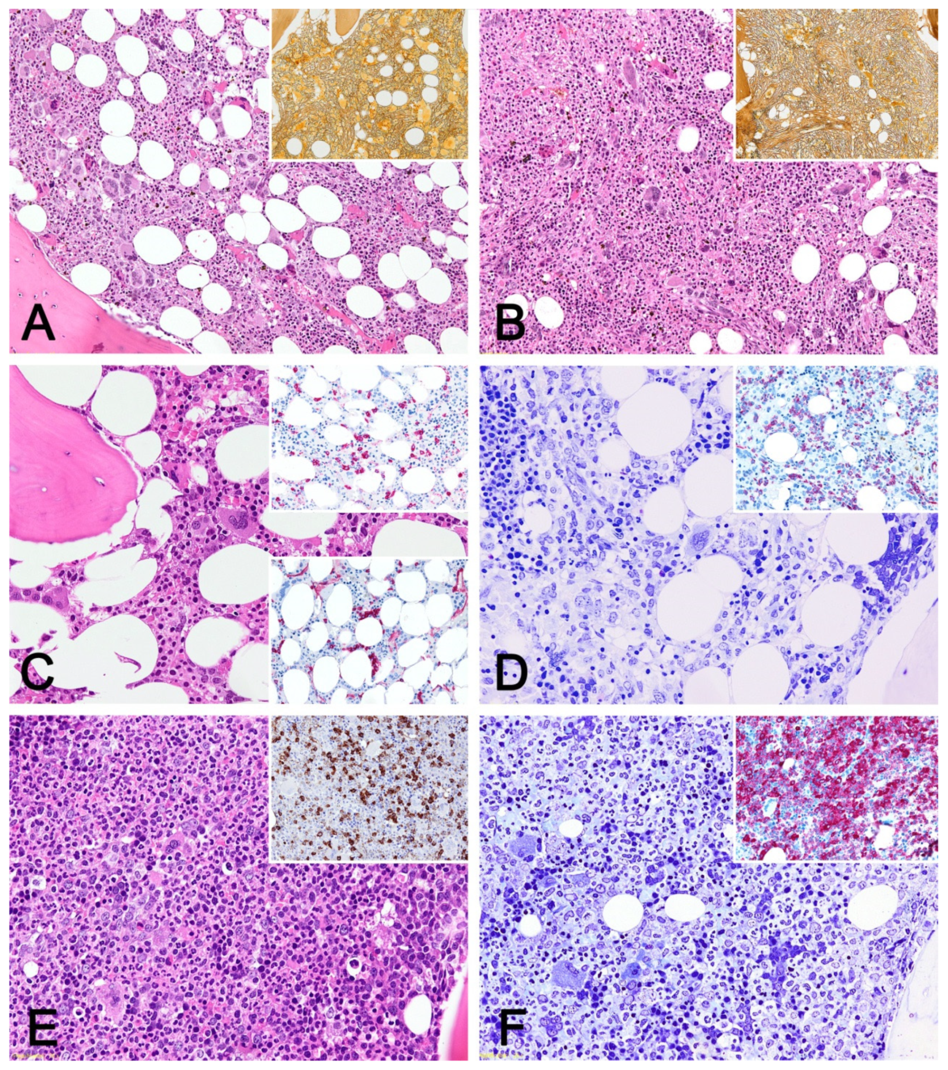 Cancers 13 05531 g001