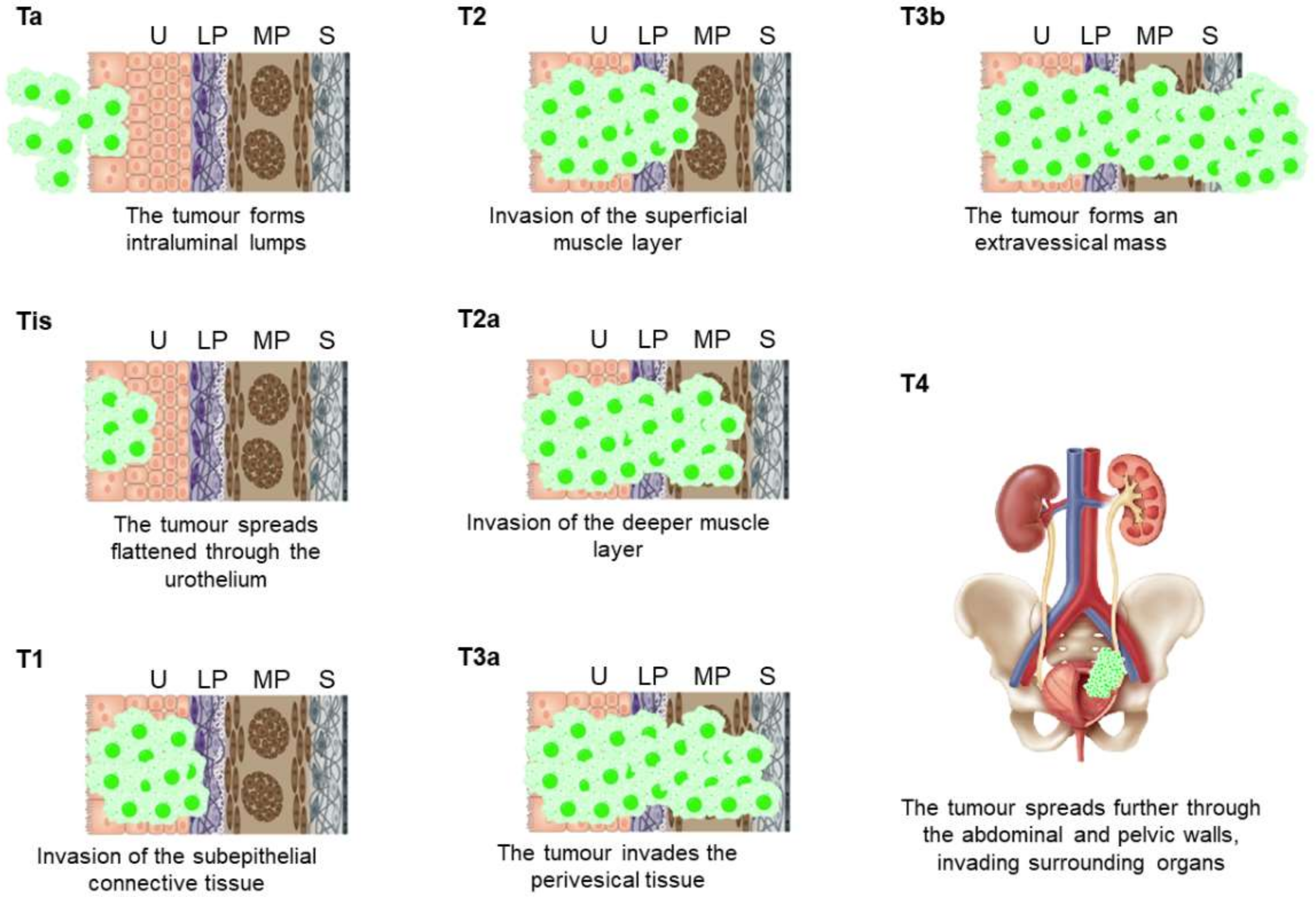 Cancers 13 05537 g001