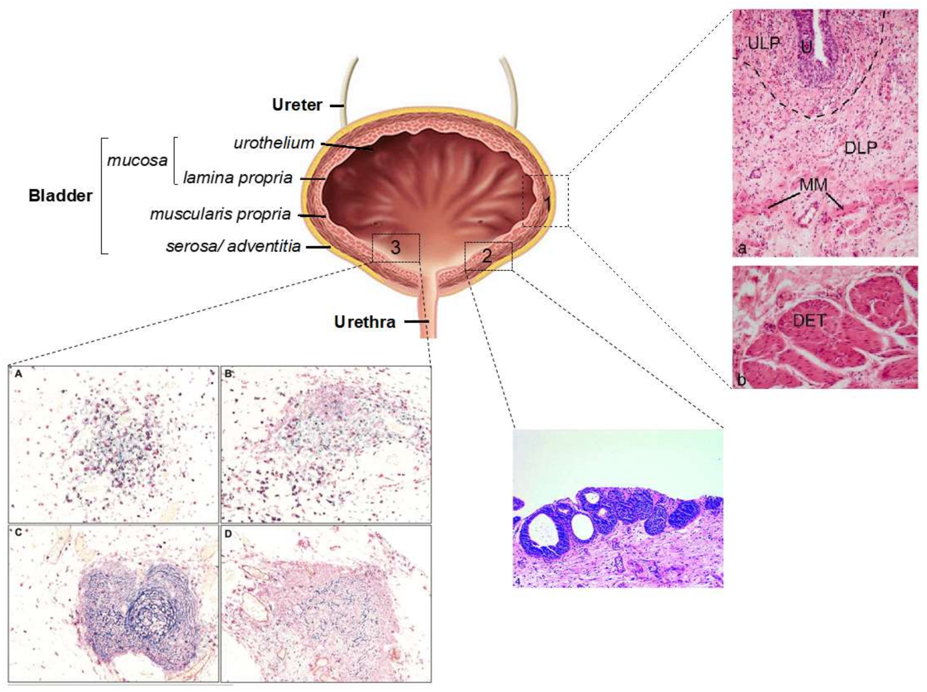 Cancers 13 05537 g007
