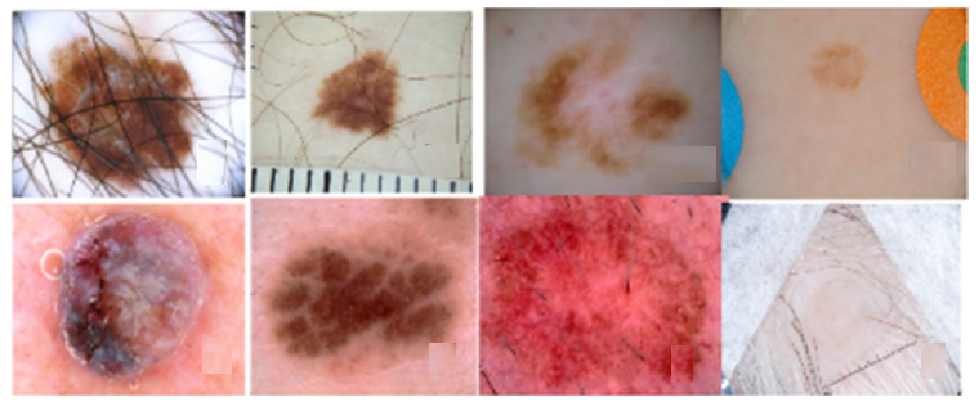 Cancers 13 05546 g006