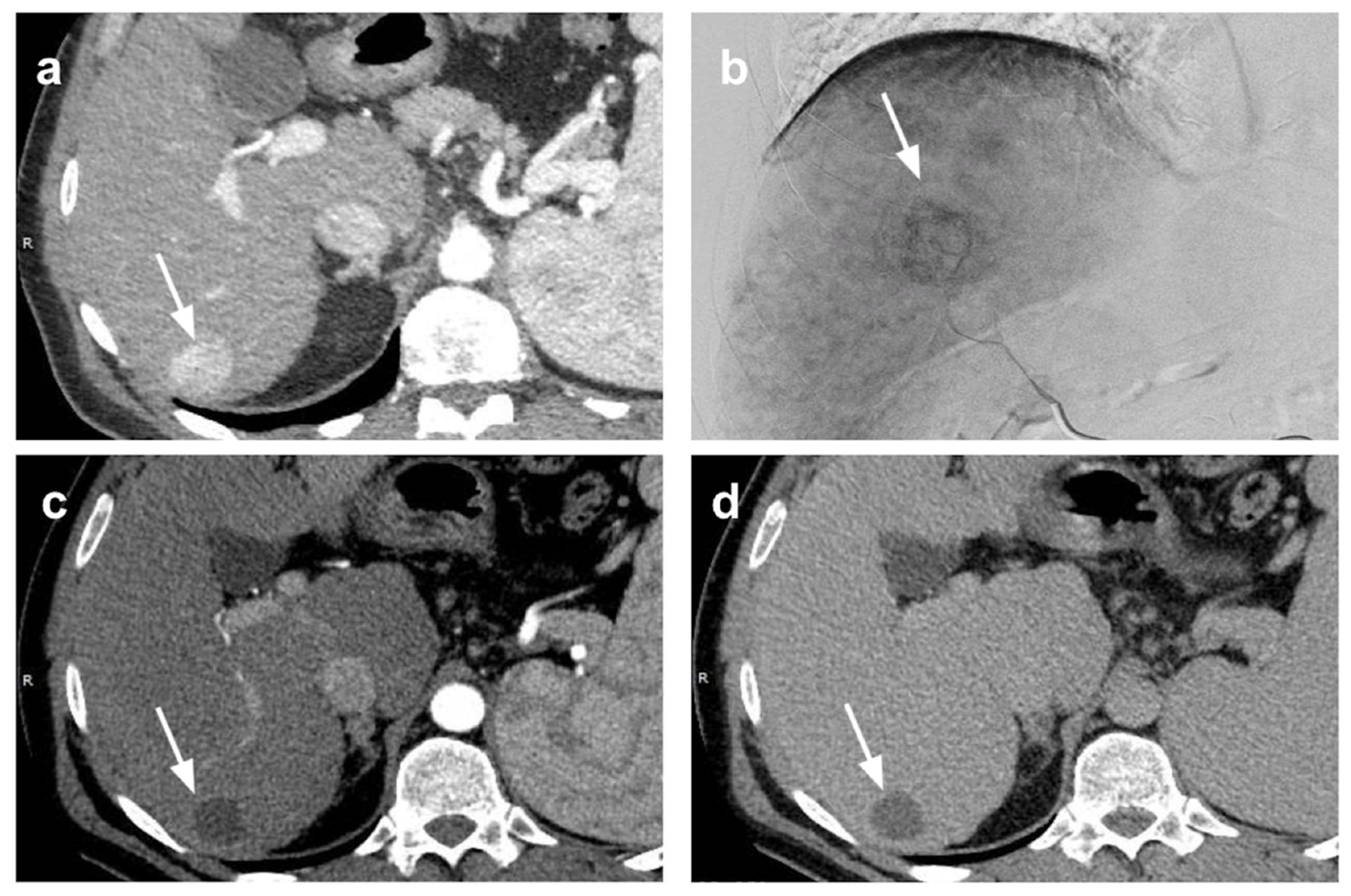 Cancers 13 05558 g001a