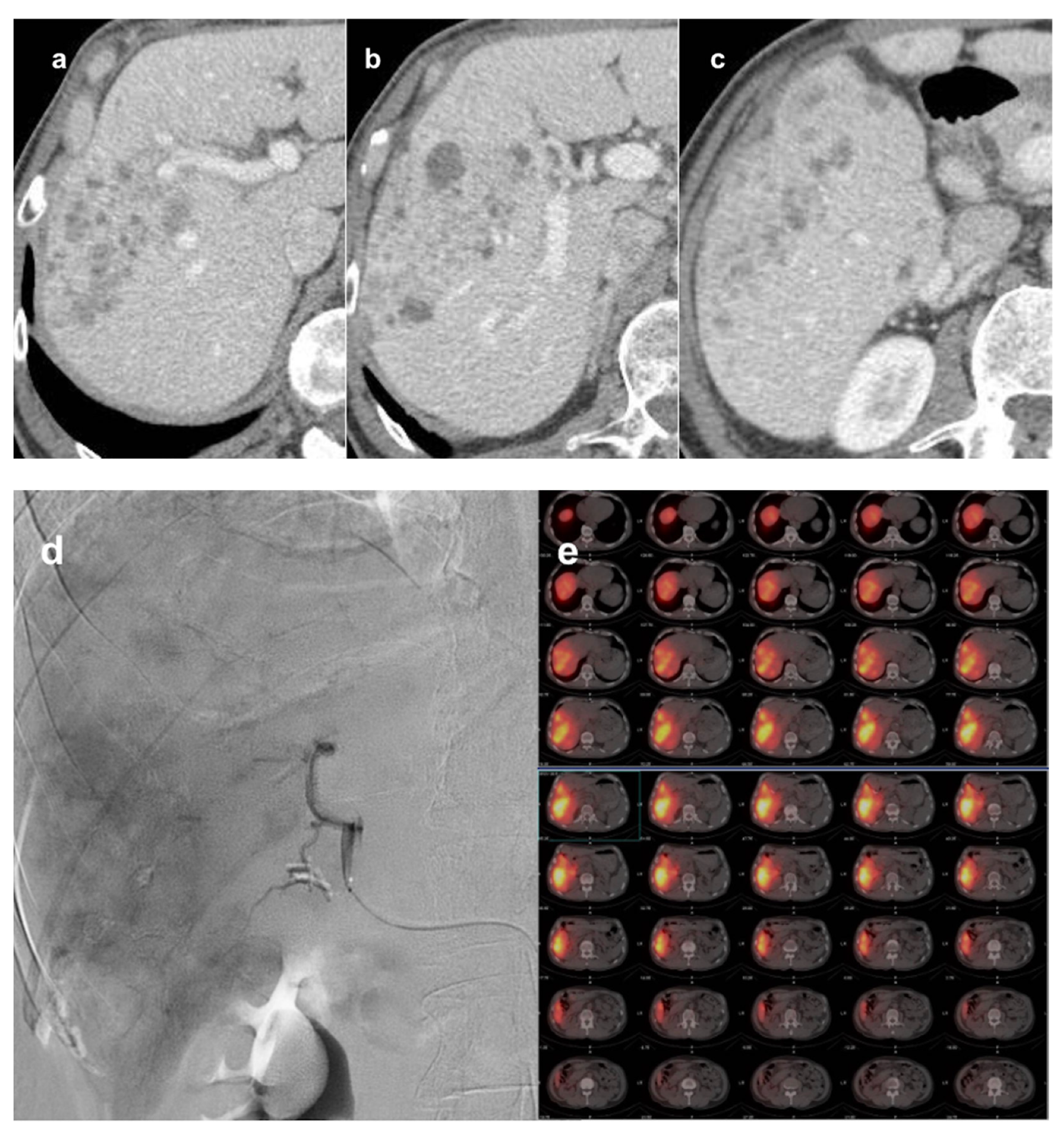 Cancers 13 05558 g002a