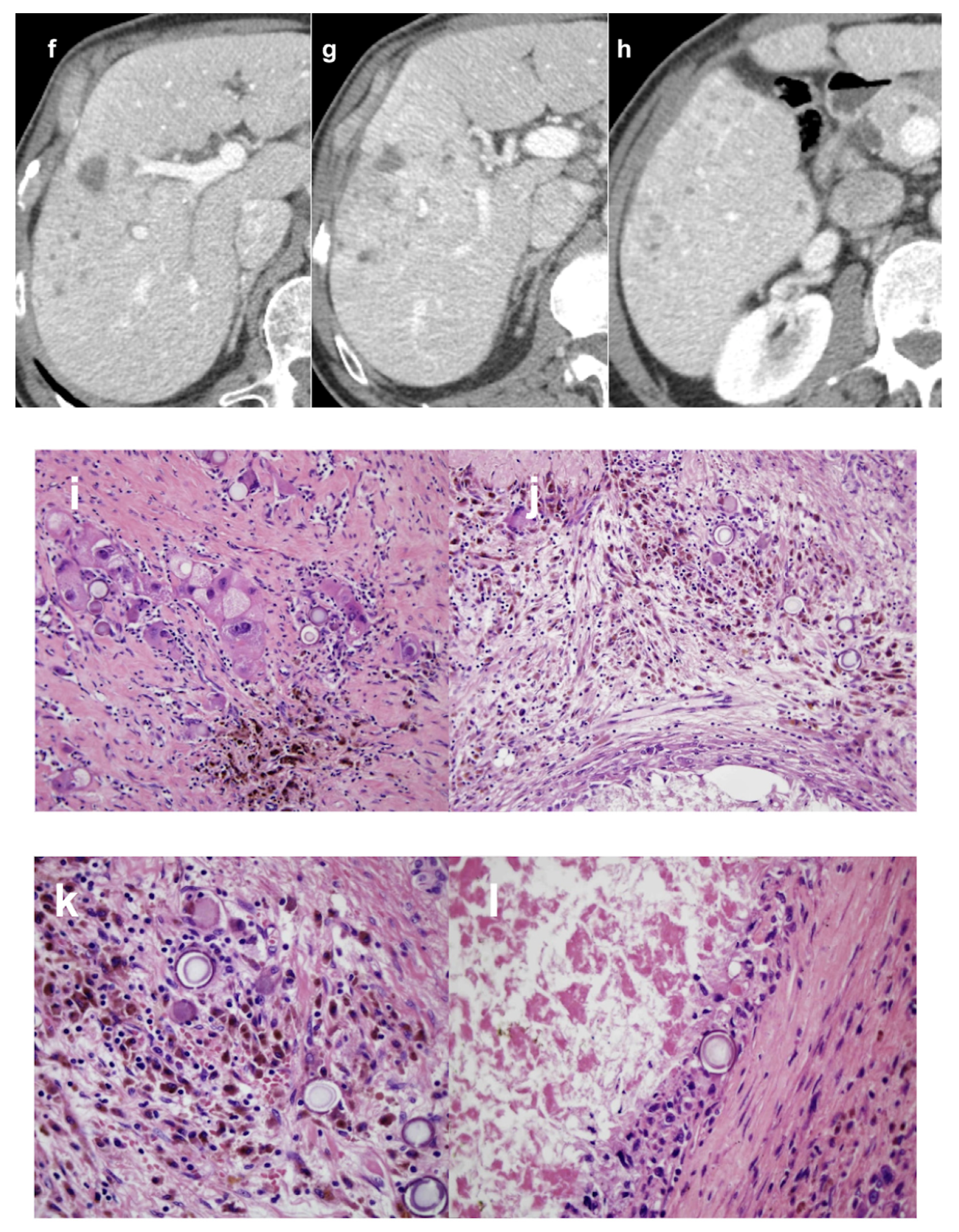 Cancers 13 05558 g002b