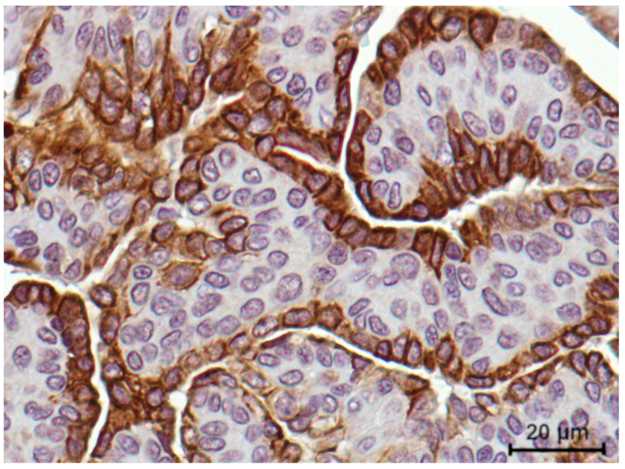 Cancers 13 05559 g005