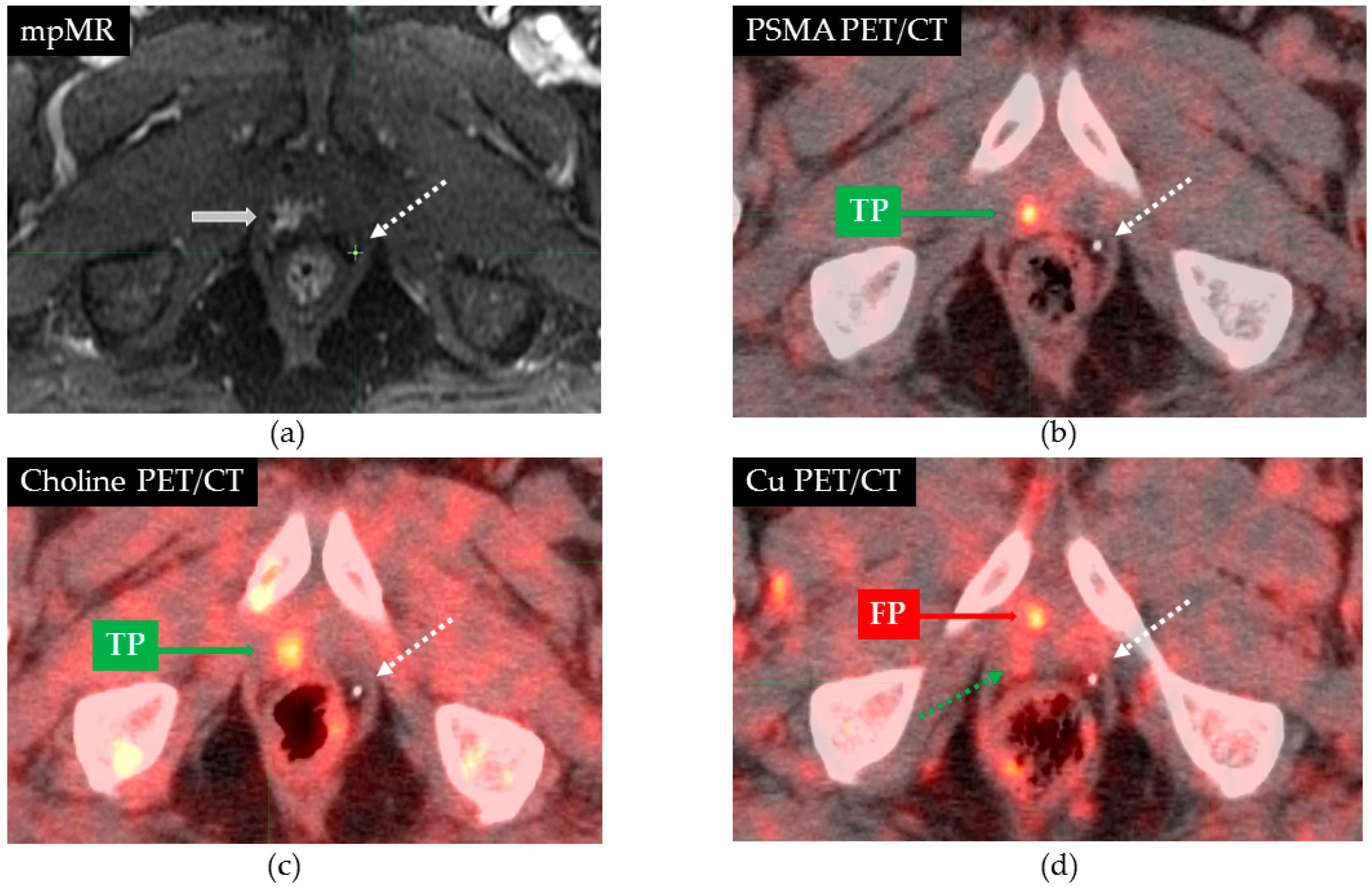 Cancers 13 05564 g001