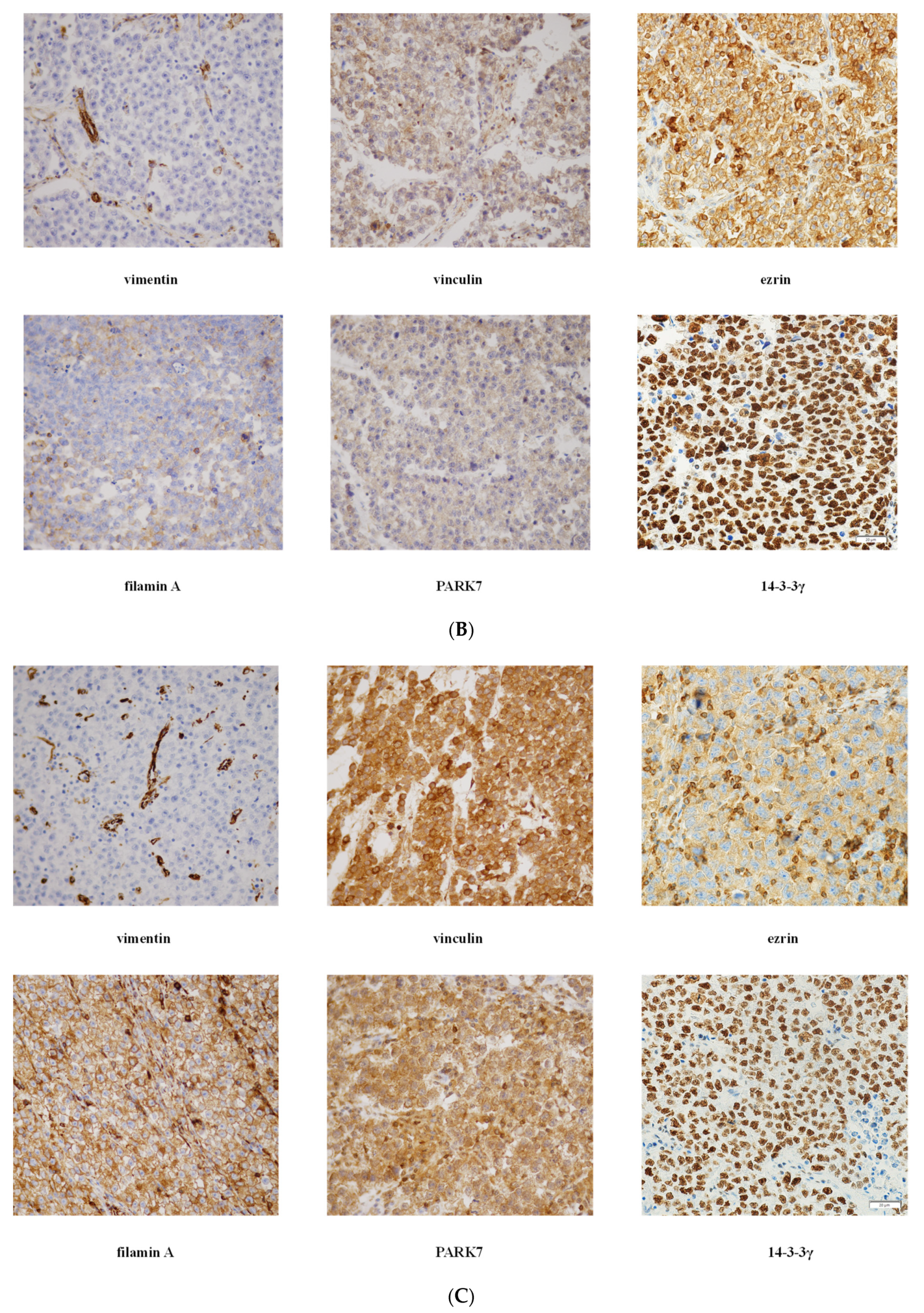 Cancers 13 05573 g002b