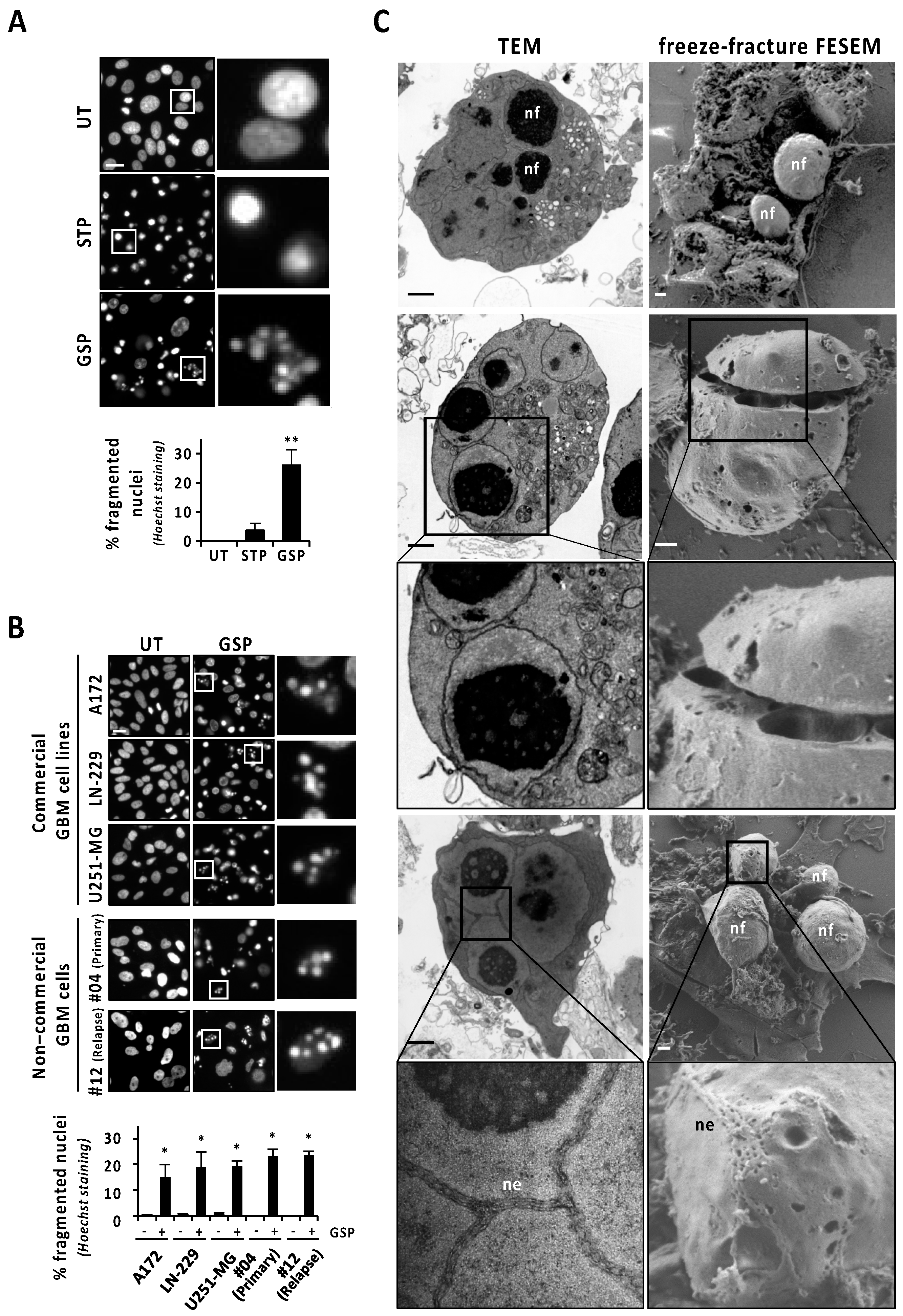 Cancers 13 05579 g001