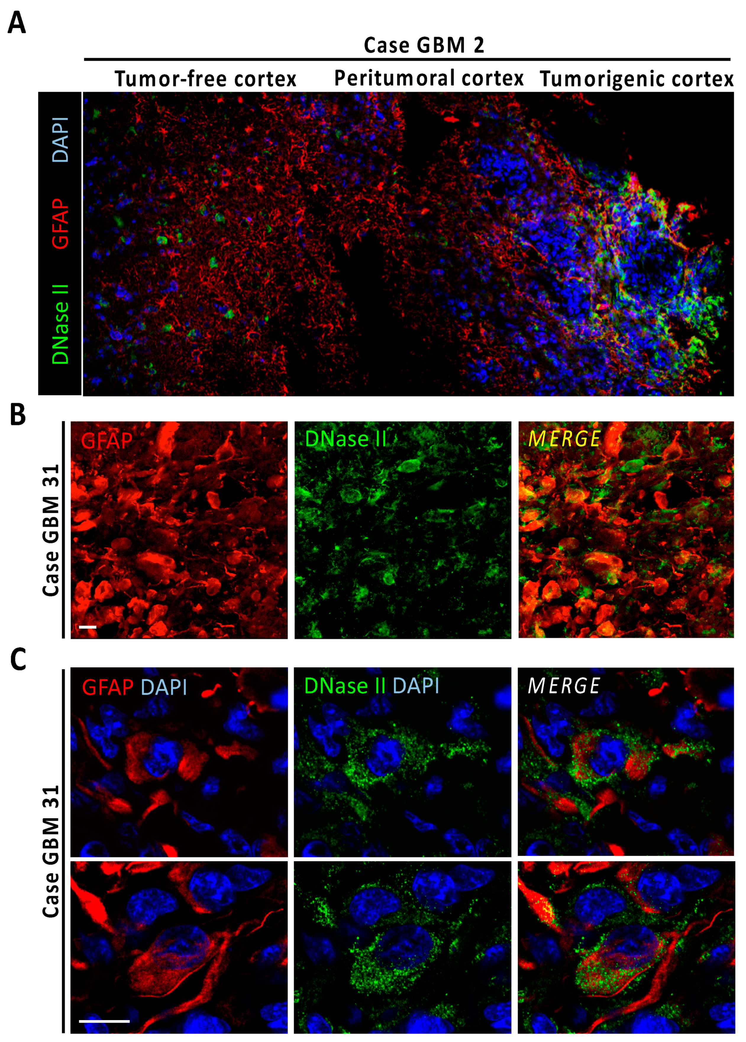 Cancers 13 05579 g004