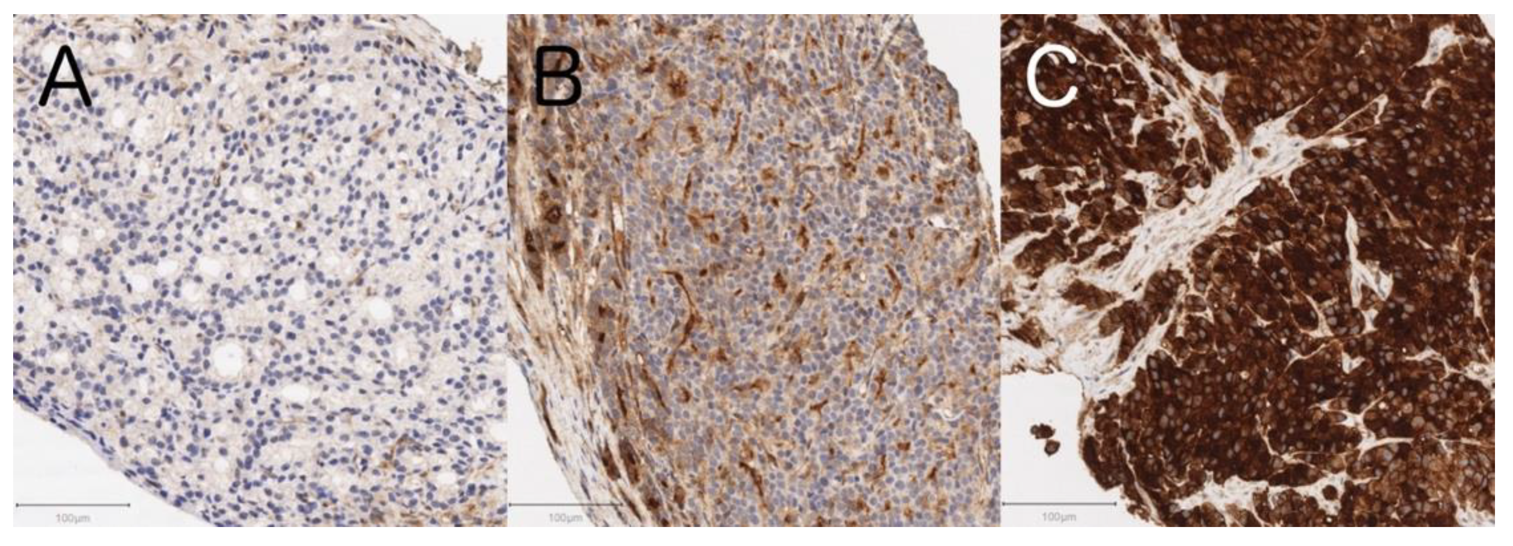 Cancers 13 05587 g002