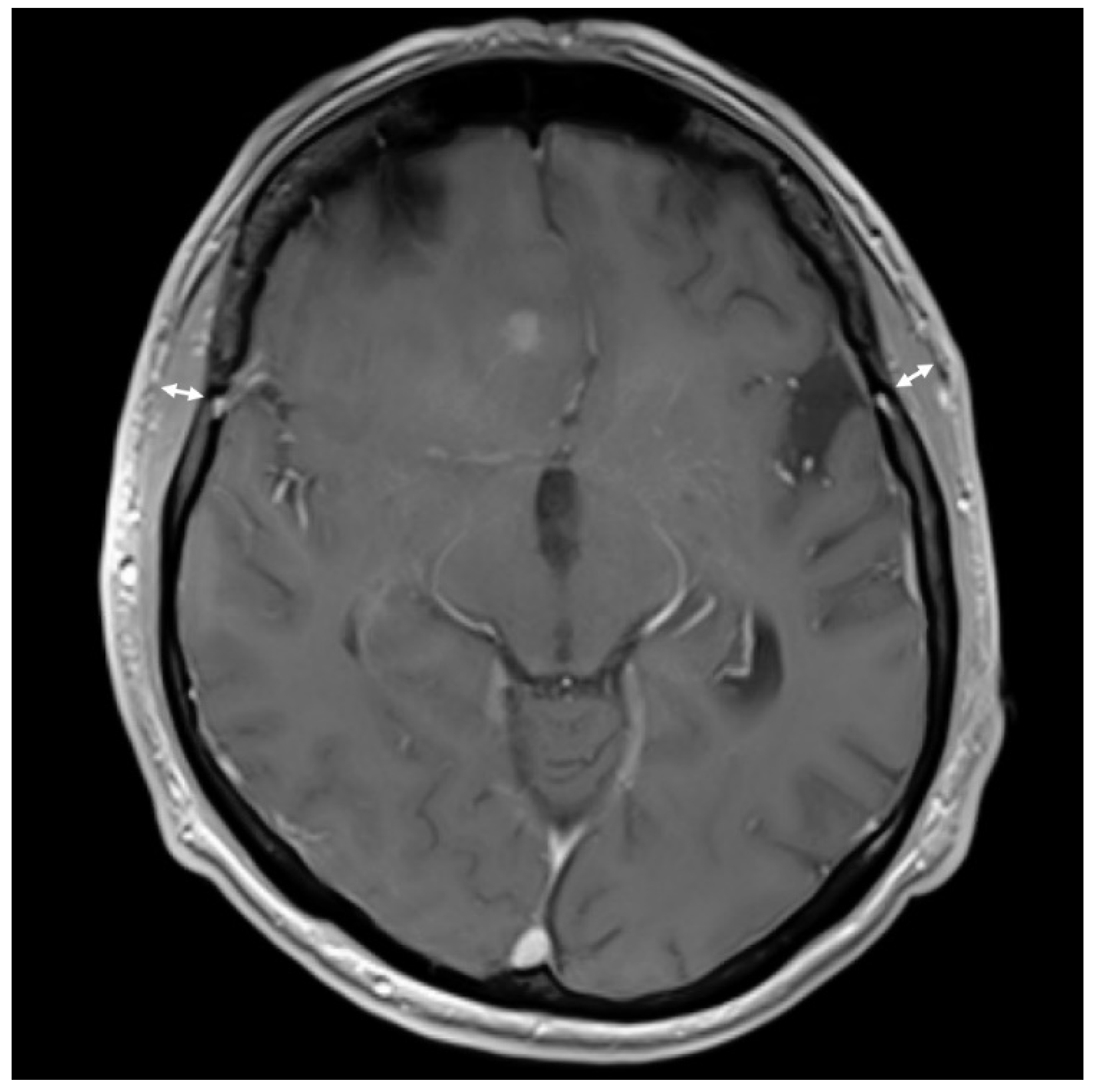 Cancers 13 05610 g001