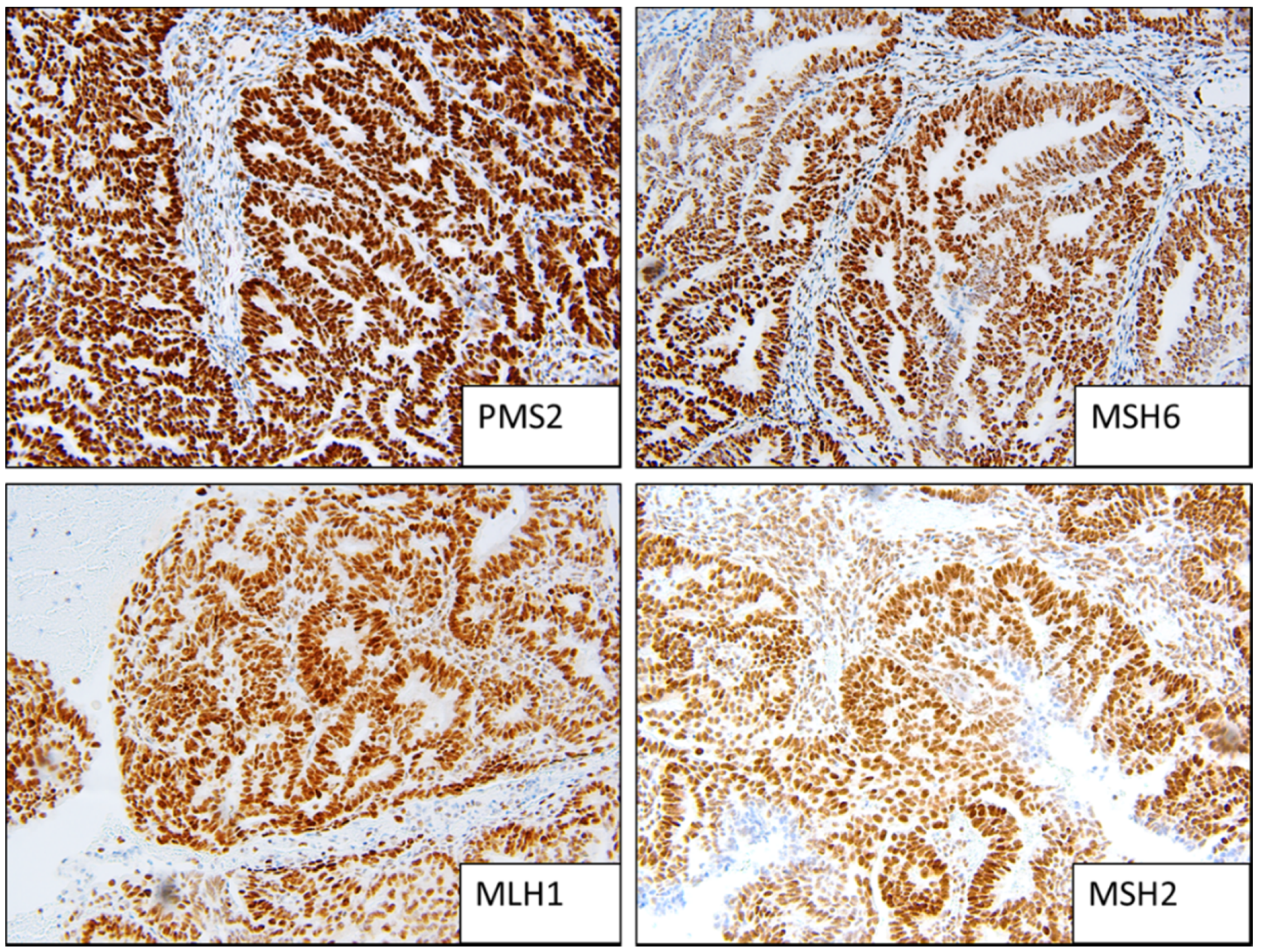 Cancers 13 05641 g001