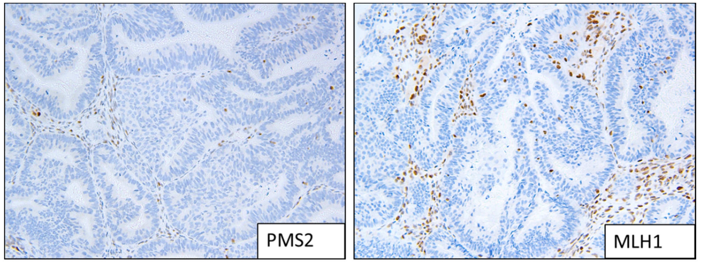 Cancers 13 05641 g002