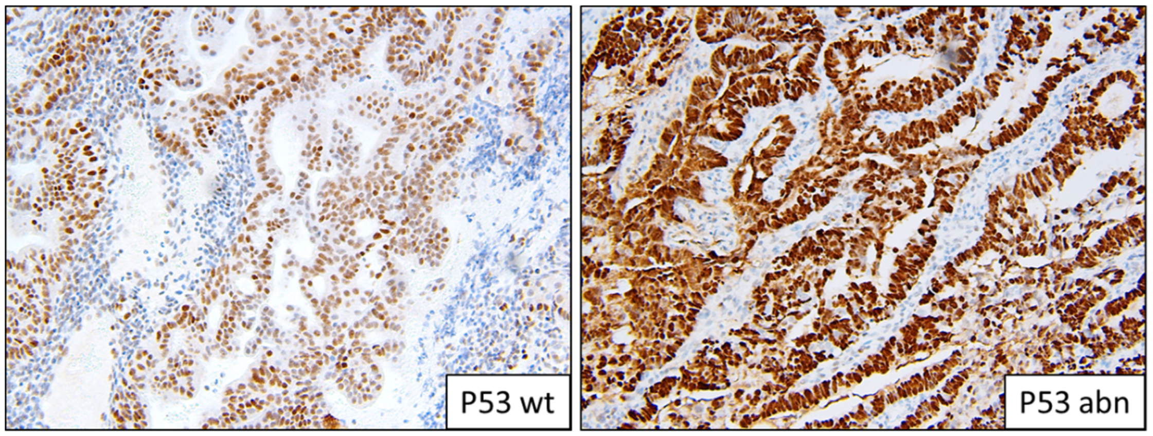 Cancers 13 05641 g003