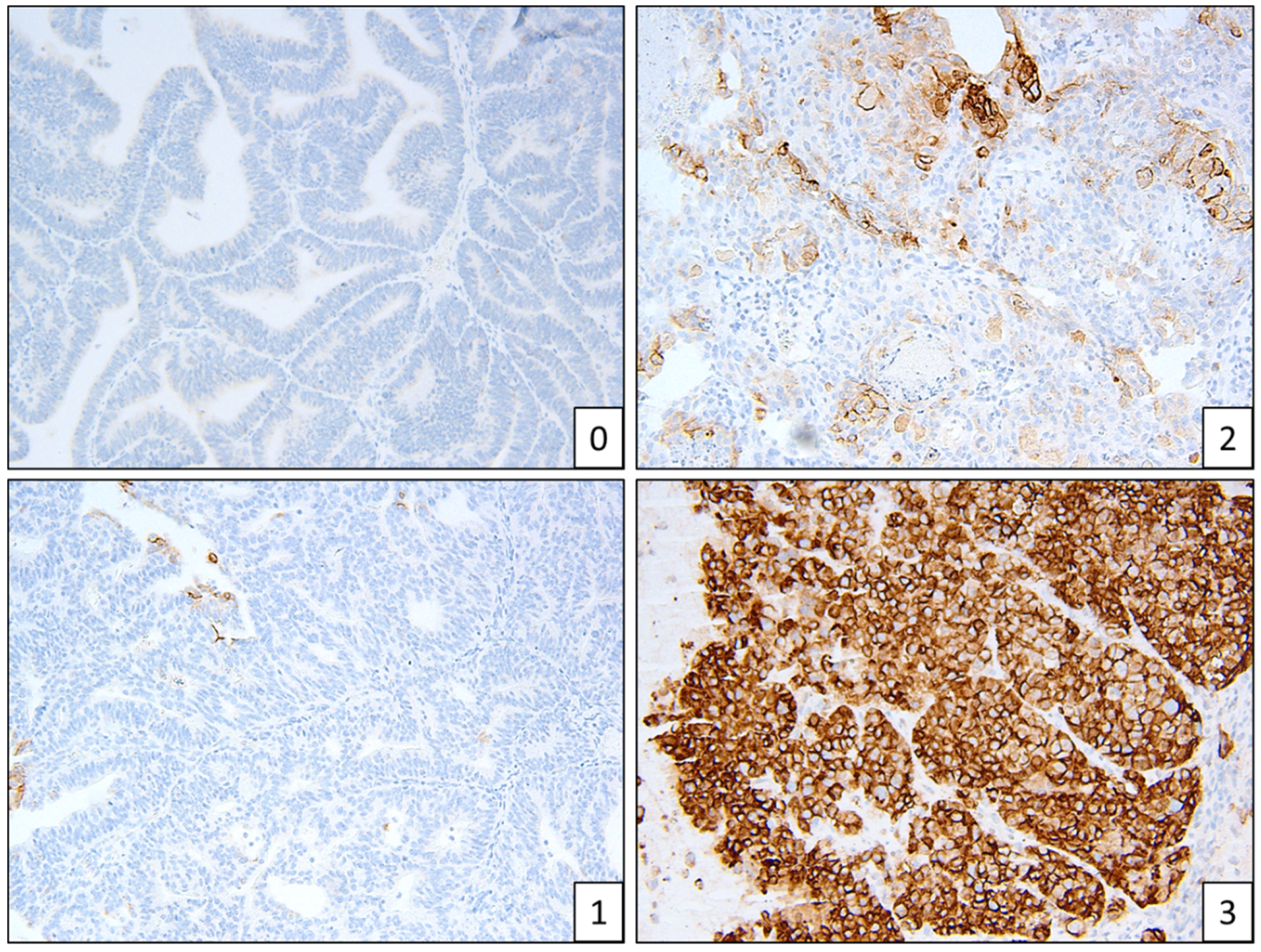 Cancers 13 05641 g004