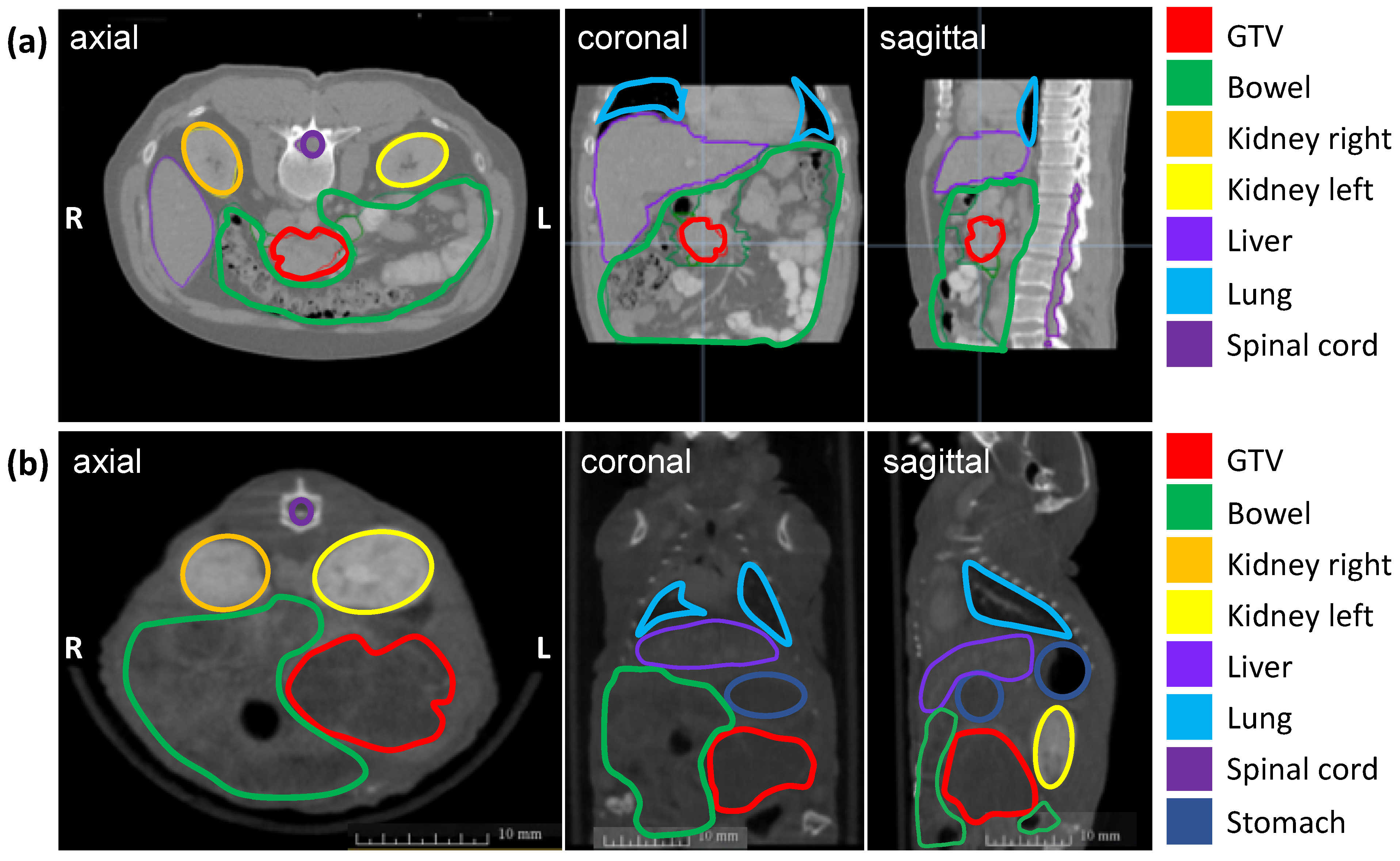 Cancers 13 05656 g001