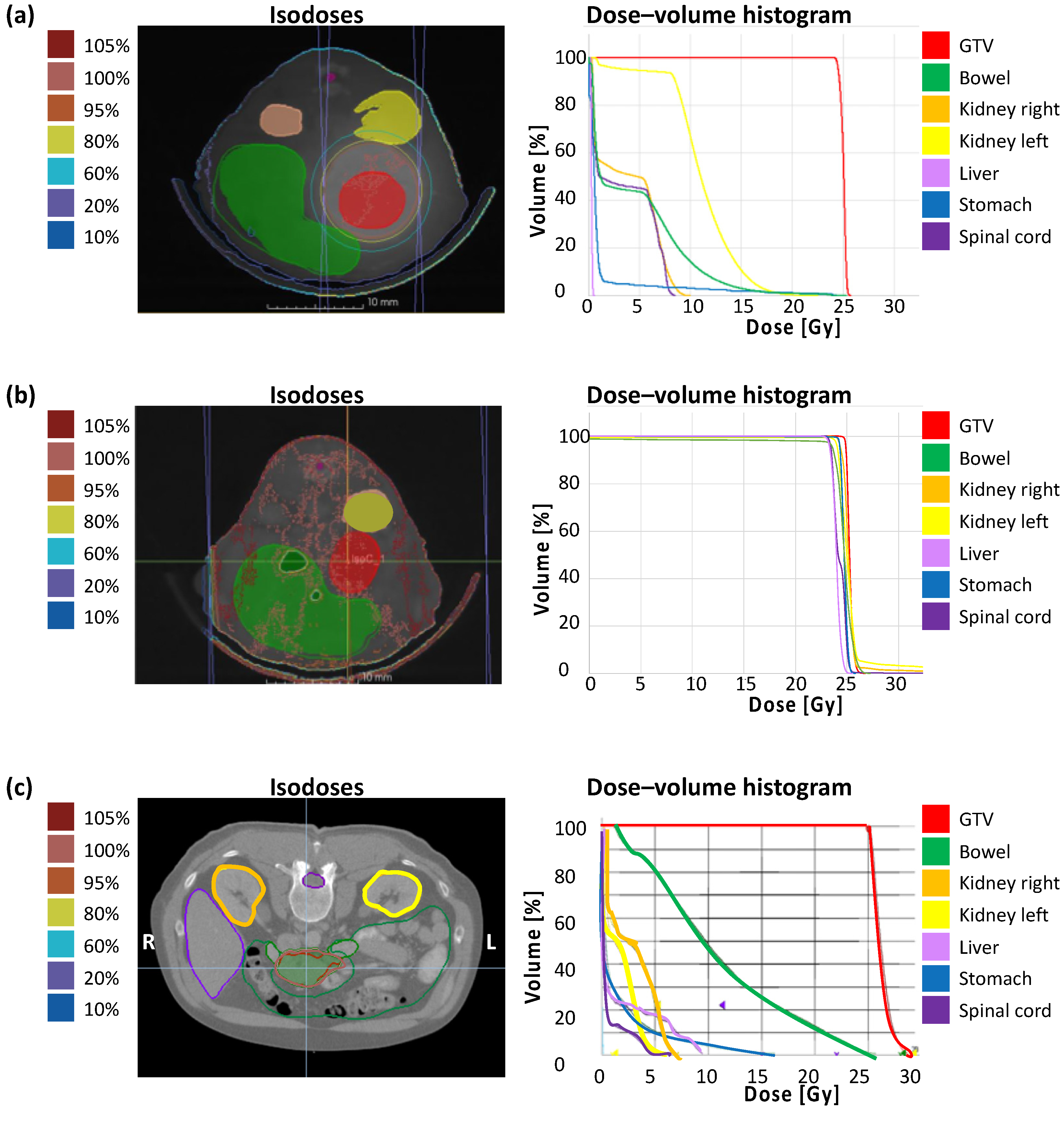 Cancers 13 05656 g003