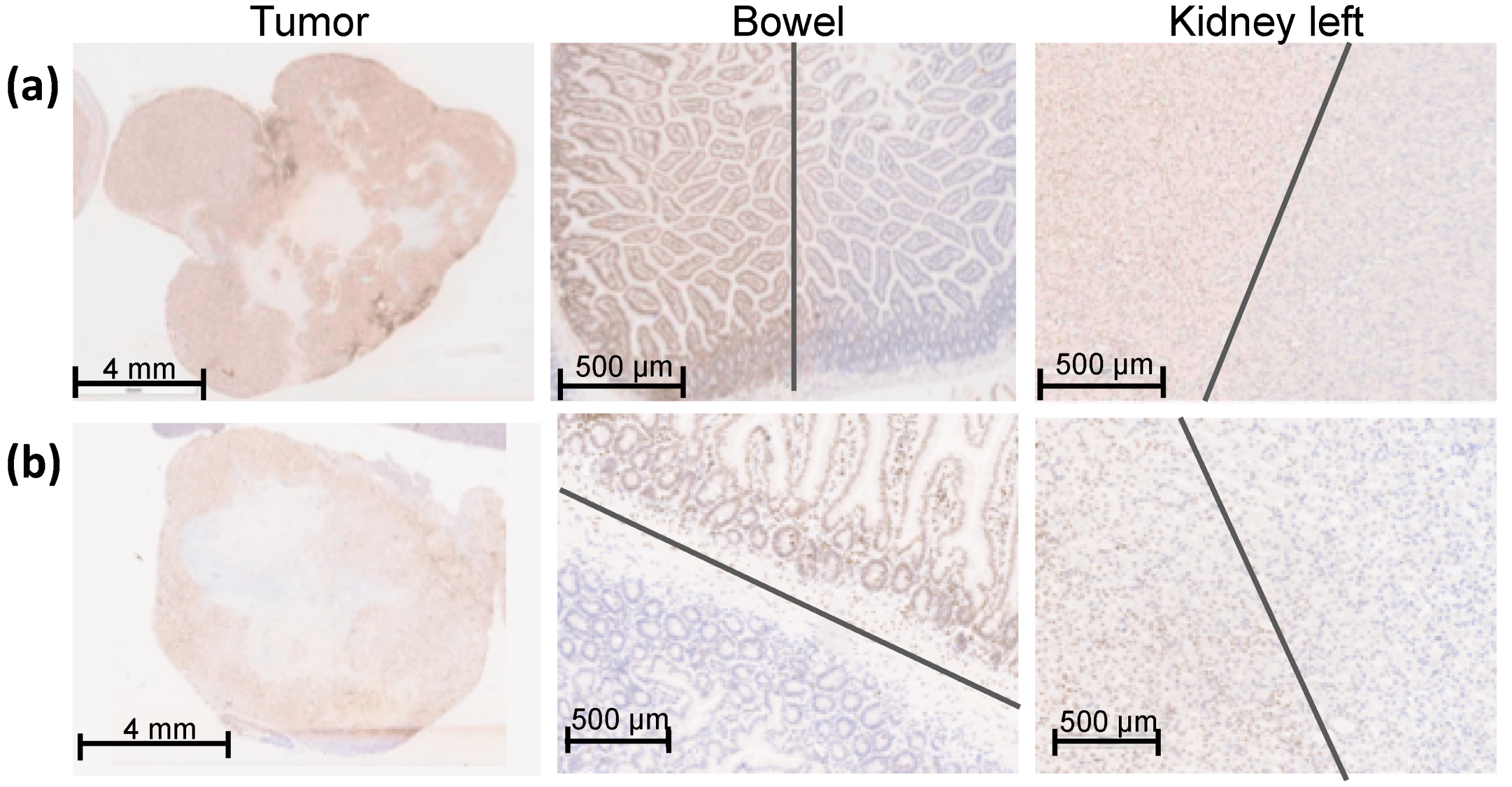 Cancers 13 05656 g004