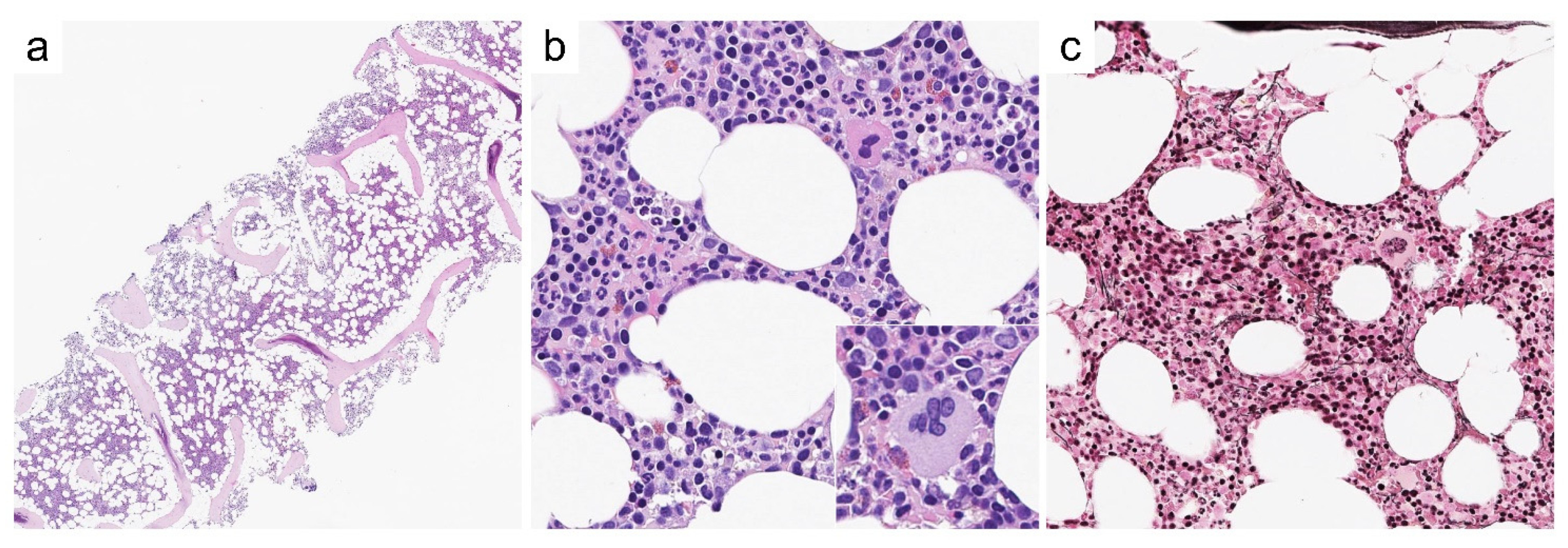 Cancers 13 05666 g002