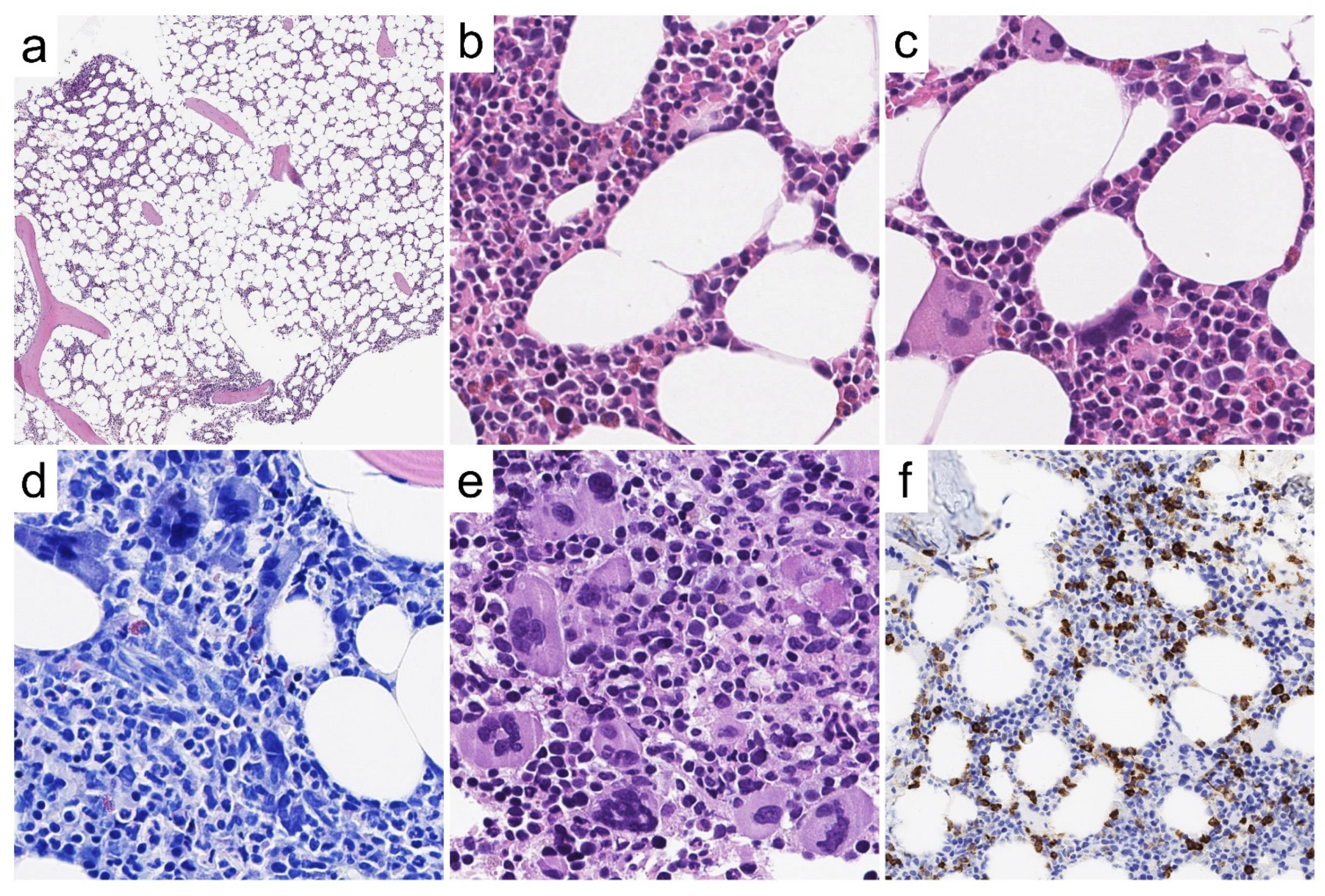 Cancers 13 05666 g004