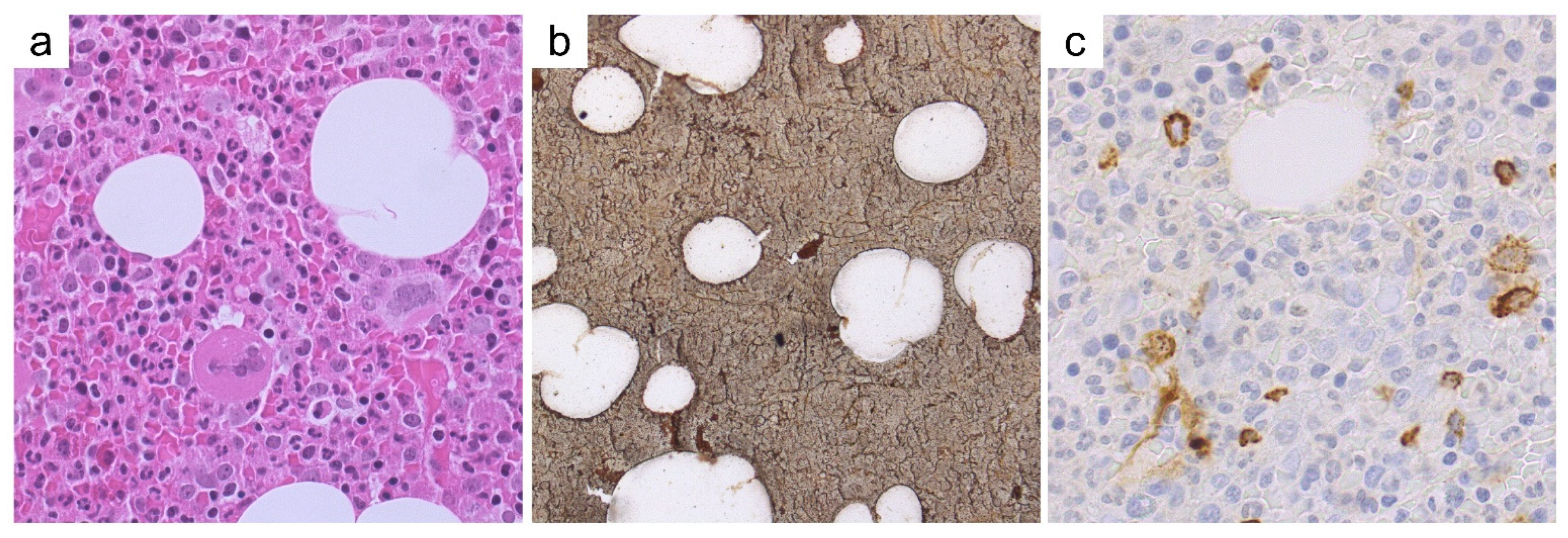 Cancers 13 05666 g005