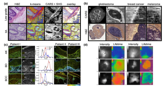 Cancers 13 05682 g002