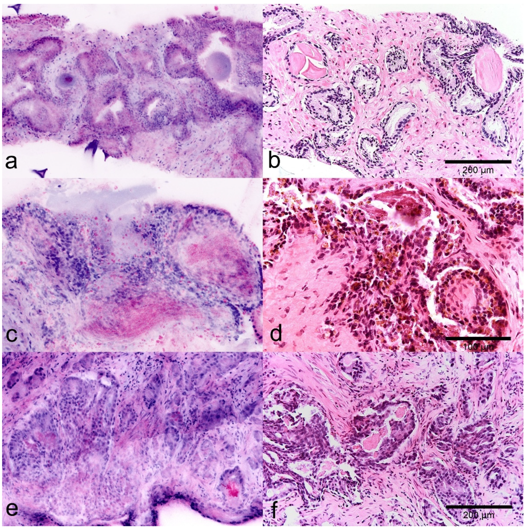 Cancers 13 05685 g002