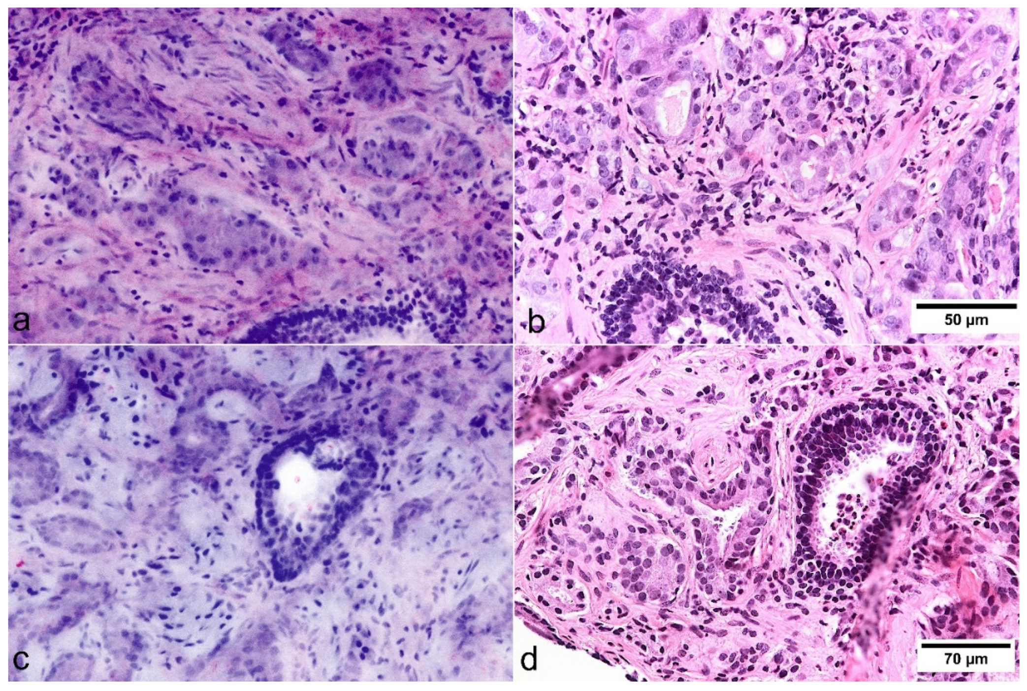 Cancers 13 05685 g003