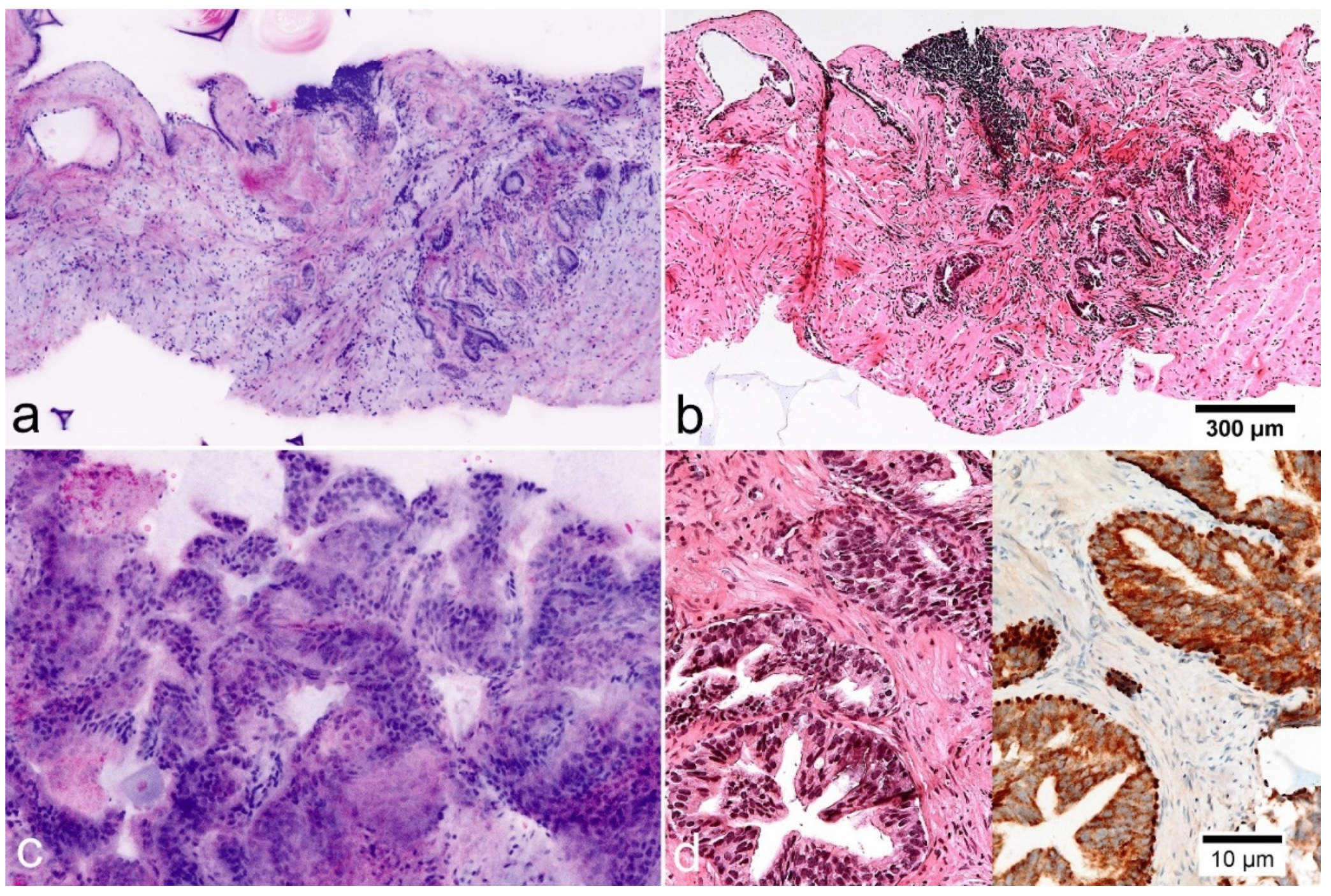 Cancers 13 05685 g004