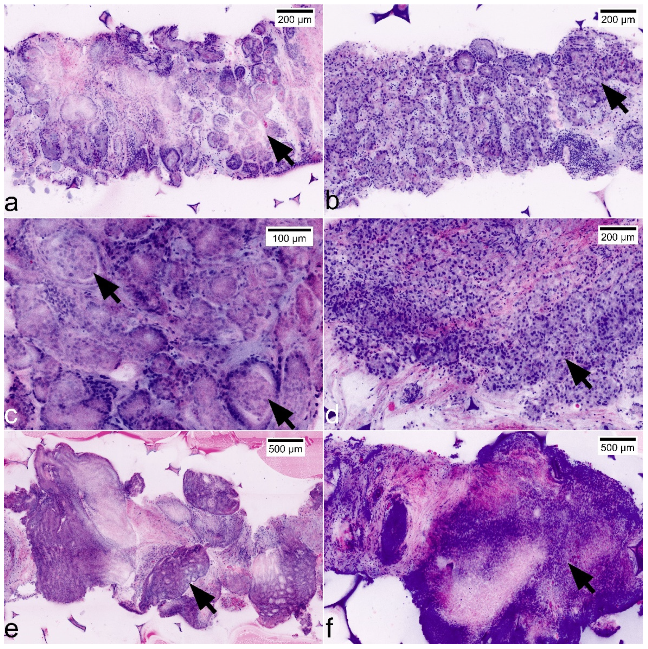 Cancers 13 05685 g005