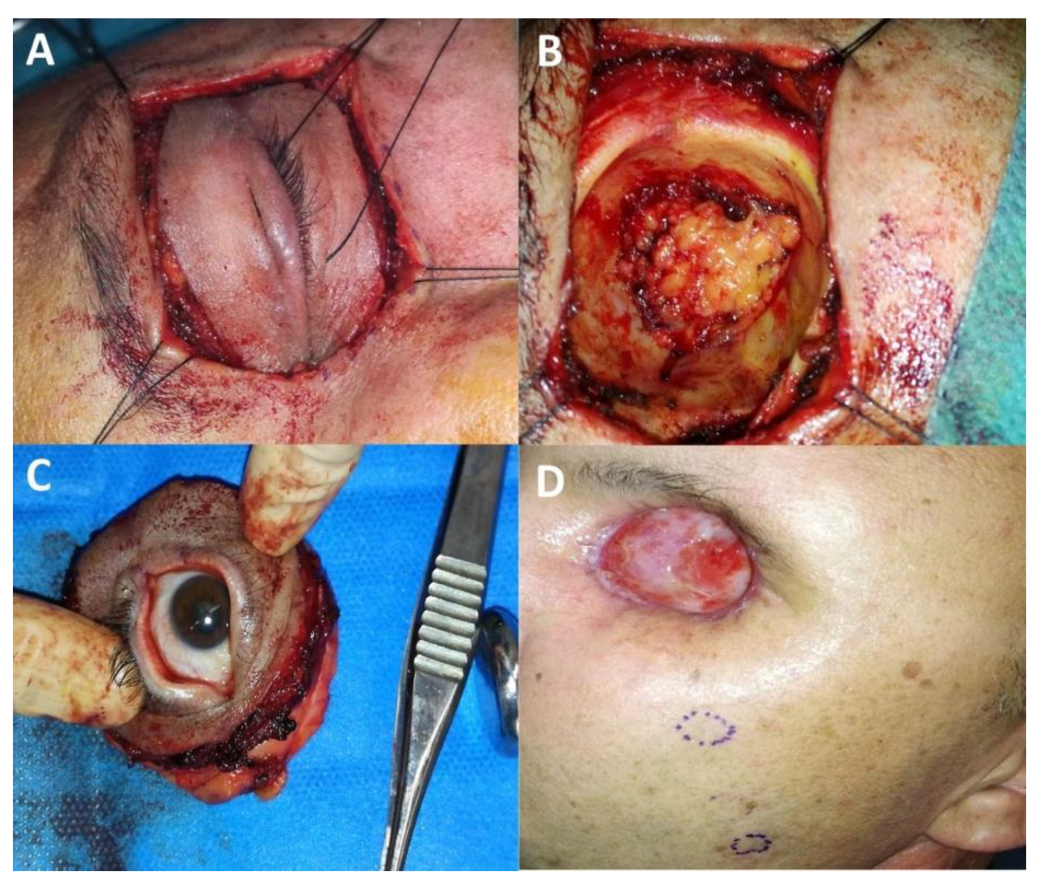 Cancers 13 05691 g004 Cancers 13 05691 g004