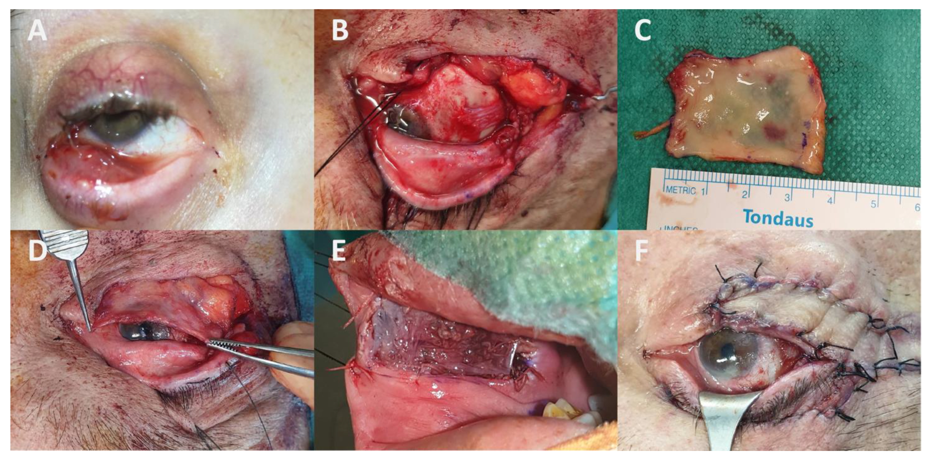 Cancers 13 05691 g006 Cancers 13 05691 g006