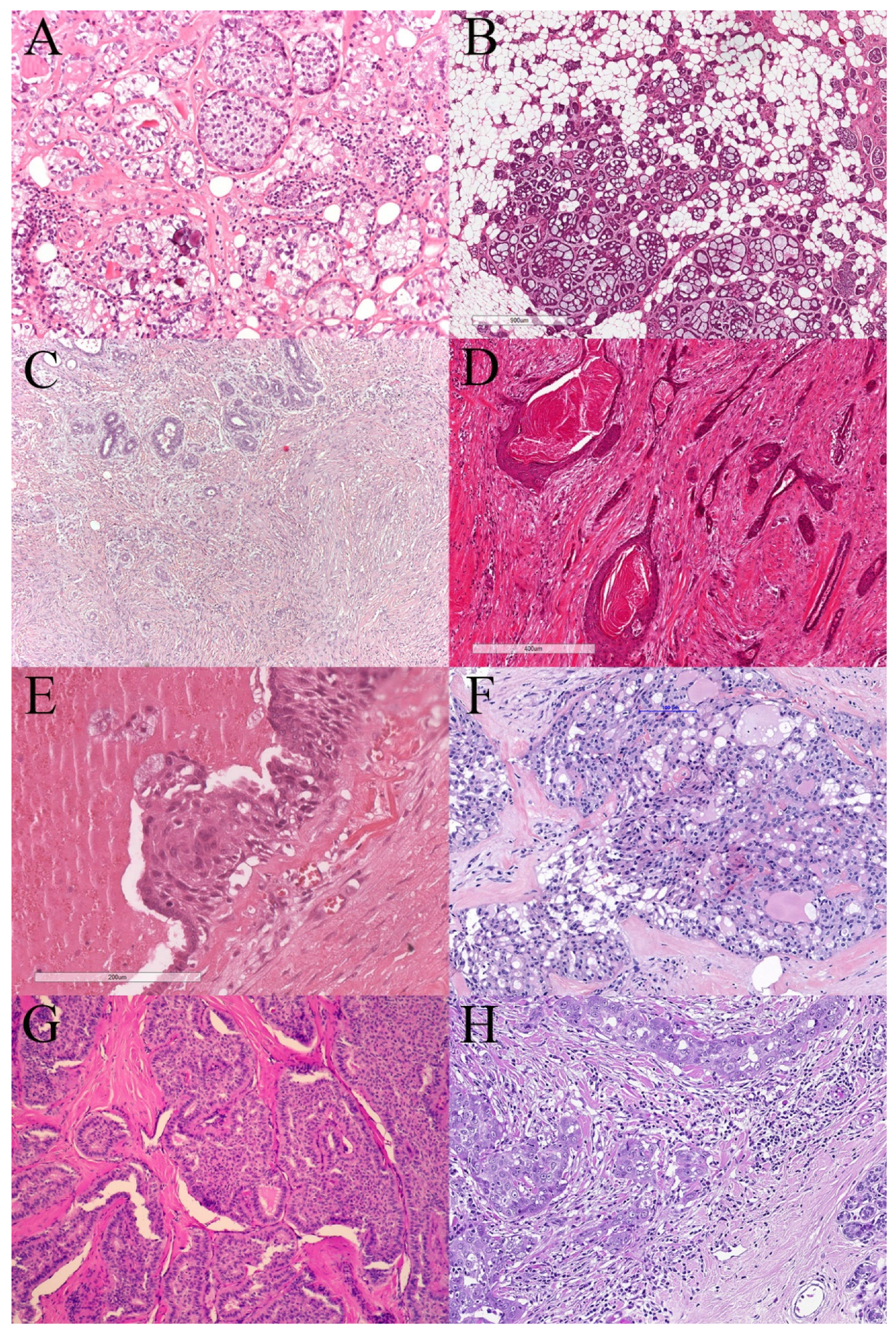 Cancers 13 05694 g001