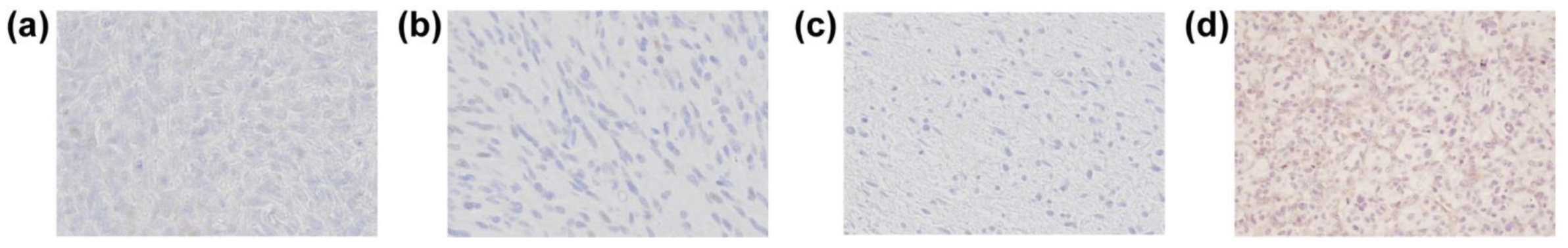 Cancers 13 05704 g004